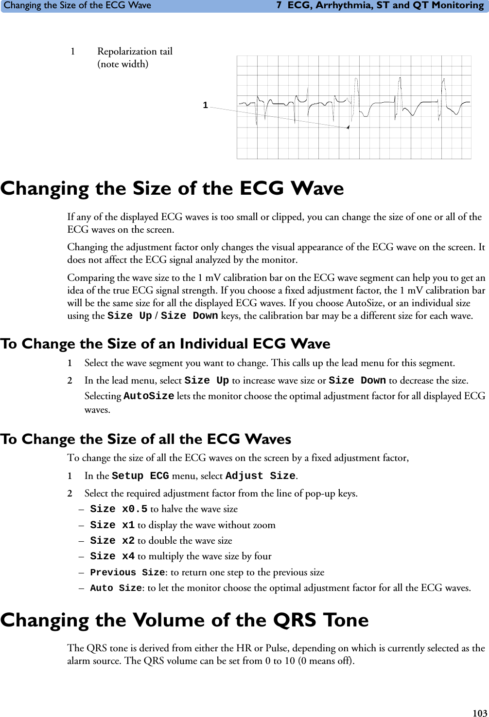 Changing the Size of the ECG Wave 7 ECG, Arrhythmia, ST and QT Monitoring103Changing the Size of the ECG WaveIf any of the displayed ECG waves is too small or clipped, you can change the size of one or all of the ECG waves on the screen.Changing the adjustment factor only changes the visual appearance of the ECG wave on the screen. It does not affect the ECG signal analyzed by the monitor.Comparing the wave size to the 1 mV calibration bar on the ECG wave segment can help you to get an idea of the true ECG signal strength. If you choose a fixed adjustment factor, the 1 mV calibration bar will be the same size for all the displayed ECG waves. If you choose AutoSize, or an individual size using the Size Up / Size Down keys, the calibration bar may be a different size for each wave. To Change the Size of an Individual ECG Wave1Select the wave segment you want to change. This calls up the lead menu for this segment.2In the lead menu, select Size Up to increase wave size or Size Down to decrease the size.Selecting AutoSize lets the monitor choose the optimal adjustment factor for all displayed ECG waves.To Change the Size of all the ECG Waves To change the size of all the ECG waves on the screen by a fixed adjustment factor, 1In the Setup ECG menu, select Adjust Size. 2Select the required adjustment factor from the line of pop-up keys. –Size x0.5 to halve the wave size –Size x1 to display the wave without zoom–Size x2 to double the wave size –Size x4 to multiply the wave size by four–Previous Size: to return one step to the previous size–Auto Size: to let the monitor choose the optimal adjustment factor for all the ECG waves. Changing the Volume of the QRS ToneThe QRS tone is derived from either the HR or Pulse, depending on which is currently selected as the alarm source. The QRS volume can be set from 0 to 10 (0 means off). 1 Repolarization tail (note width)1