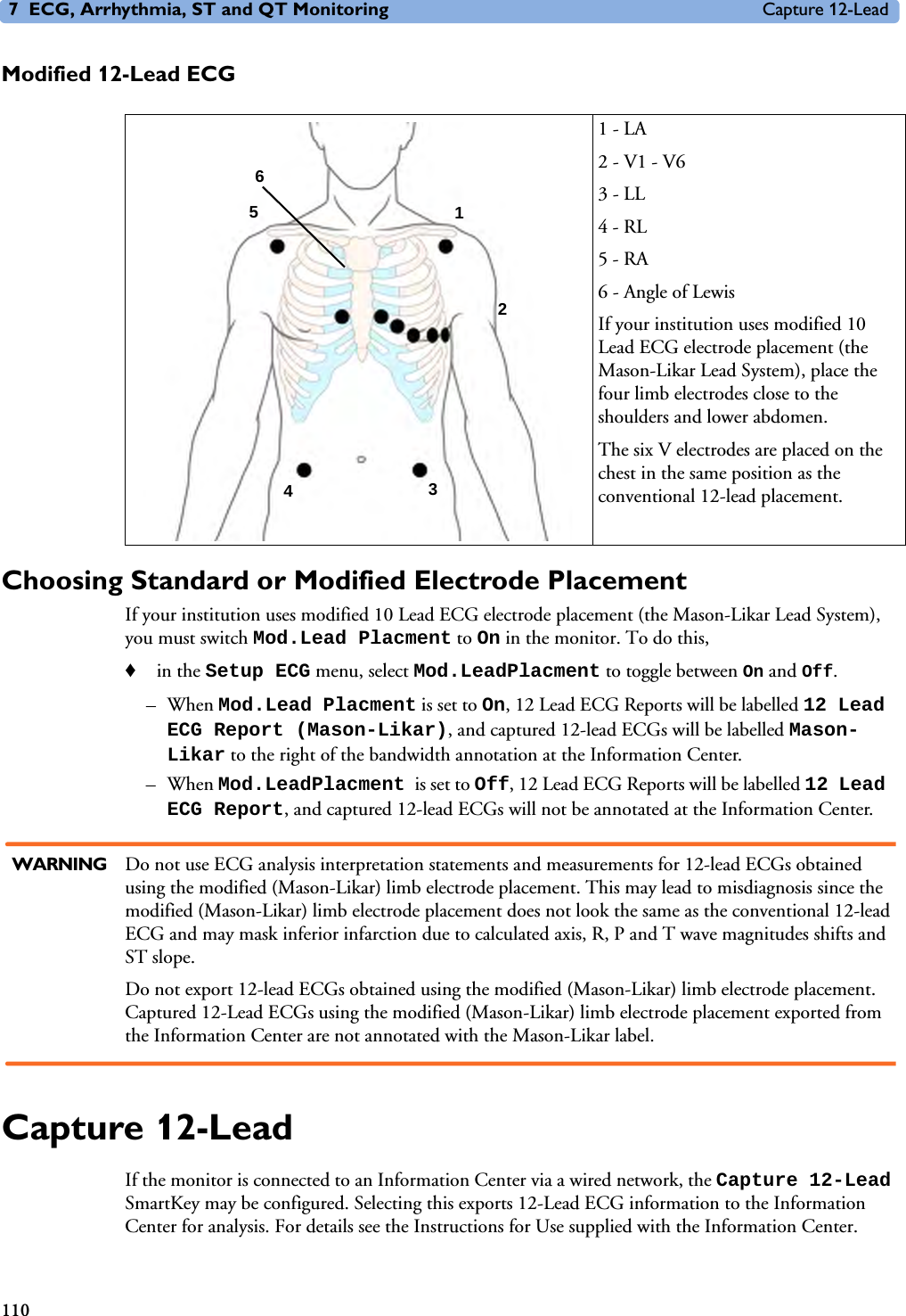 7 ECG, Arrhythmia, ST and QT Monitoring Capture 12-Lead110Modified 12-Lead ECGChoosing Standard or Modified Electrode PlacementIf your institution uses modified 10 Lead ECG electrode placement (the Mason-Likar Lead System), you must switch Mod.Lead Placment to On in the monitor. To do this,♦in the Setup ECG menu, select Mod.LeadPlacment to toggle between On and Off.–When Mod.Lead Placment is set to On, 12 Lead ECG Reports will be labelled 12 Lead ECG Report (Mason-Likar), and captured 12-lead ECGs will be labelled Mason-Likar to the right of the bandwidth annotation at the Information Center.–When Mod.LeadPlacment is set to Off, 12 Lead ECG Reports will be labelled 12 Lead ECG Report, and captured 12-lead ECGs will not be annotated at the Information Center.WARNING Do not use ECG analysis interpretation statements and measurements for 12-lead ECGs obtained using the modified (Mason-Likar) limb electrode placement. This may lead to misdiagnosis since the modified (Mason-Likar) limb electrode placement does not look the same as the conventional 12-lead ECG and may mask inferior infarction due to calculated axis, R, P and T wave magnitudes shifts and ST slope. Do not export 12-lead ECGs obtained using the modified (Mason-Likar) limb electrode placement. Captured 12-Lead ECGs using the modified (Mason-Likar) limb electrode placement exported from the Information Center are not annotated with the Mason-Likar label. Capture 12-LeadIf the monitor is connected to an Information Center via a wired network, the Capture 12-Lead SmartKey may be configured. Selecting this exports 12-Lead ECG information to the Information Center for analysis. For details see the Instructions for Use supplied with the Information Center. 1 - LA2 - V1 - V63 - LL4 - RL5 - RA6 - Angle of LewisIf your institution uses modified 10 Lead ECG electrode placement (the Mason-Likar Lead System), place the four limb electrodes close to the shoulders and lower abdomen.The six V electrodes are placed on the chest in the same position as the conventional 12-lead placement.1 35462