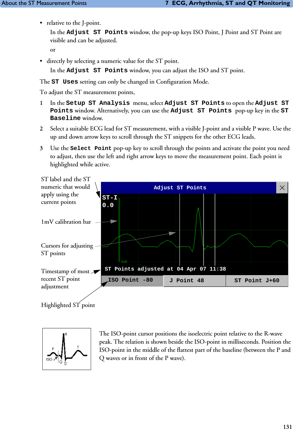 About the ST Measurement Points 7 ECG, Arrhythmia, ST and QT Monitoring131• relative to the J-point. In the Adjust ST Points window, the pop-up keys ISO Point, J Point and ST Point are visible and can be adjusted. or• directly by selecting a numeric value for the ST point. In the Adjust ST Points window, you can adjust the ISO and ST point. The ST Uses setting can only be changed in Configuration Mode. To adjust the ST measurement points, 1In the Setup ST Analysis menu, select Adjust ST Points to open the Adjust ST Points window. Alternatively, you can use the Adjust ST Points pop-up key in the ST Baseline window.2Select a suitable ECG lead for ST measurement, with a visible J-point and a visible P wave. Use the up and down arrow keys to scroll through the ST snippets for the other ECG leads. 3Use the Select Point pop-up key to scroll through the points and activate the point you need to adjust, then use the left and right arrow keys to move the measurement point. Each point is highlighted while active. The ISO-point cursor positions the isoelectric point relative to the R-wave peak. The relation is shown beside the ISO-point in milliseconds. Position the ISO-point in the middle of the flattest part of the baseline (between the P and Q waves or in front of the P wave). 1mV calibration barHighlighted ST pointTimestamp of most recent ST point adjustmentST-I0.0ST label and the ST numeric that would apply using the current pointsAdjust ST PointsISO Point -80 J Point 48  ST Point J+60ST Points adjusted at 04 Apr 07 11:38Cursors for adjusting ST pointsISO