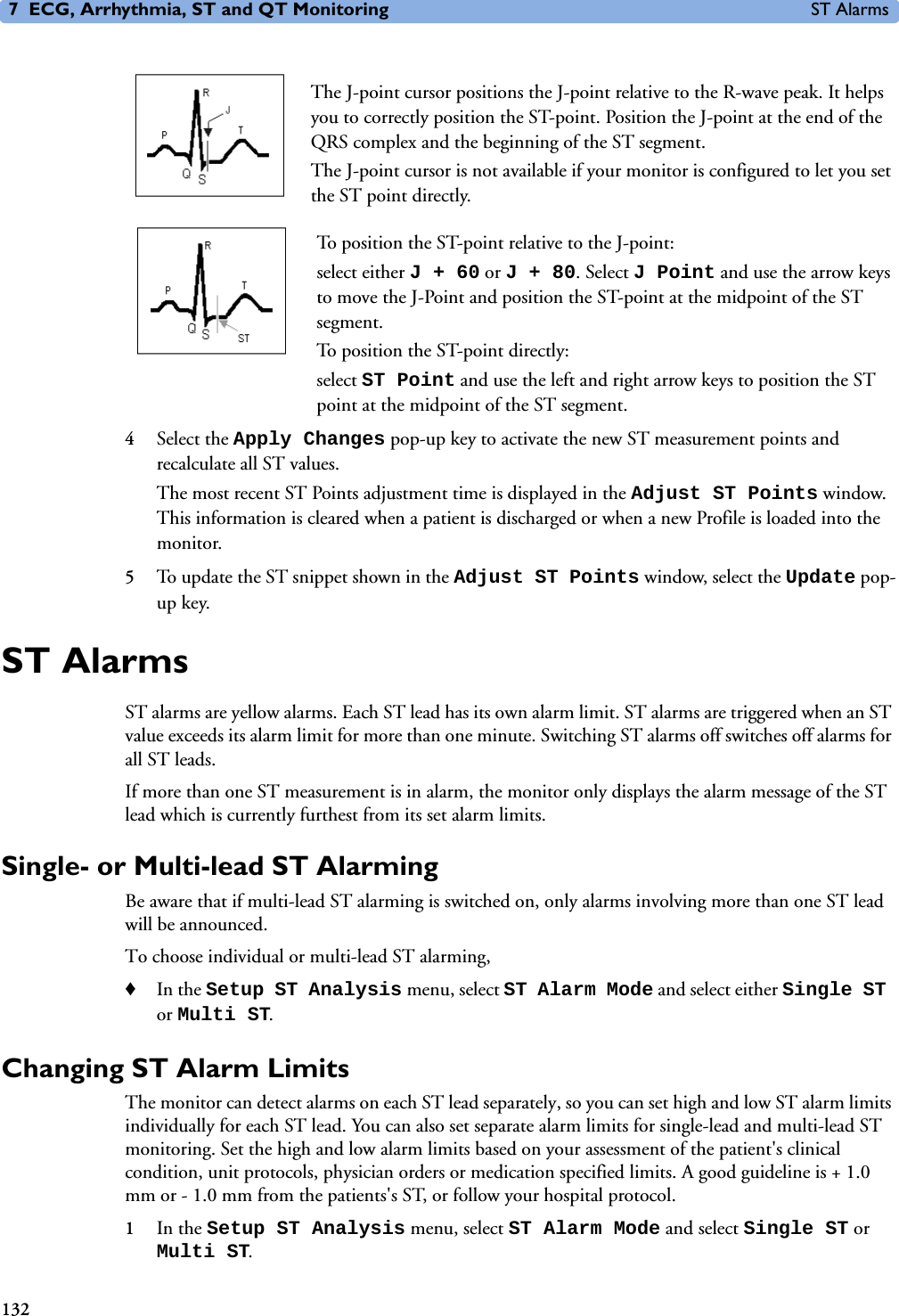 7 ECG, Arrhythmia, ST and QT Monitoring ST Alarms132The J-point cursor positions the J-point relative to the R-wave peak. It helps you to correctly position the ST-point. Position the J-point at the end of the QRS complex and the beginning of the ST segment. The J-point cursor is not available if your monitor is configured to let you set the ST point directly. To position the ST-point relative to the J-point:select either J+60 or J+80. Select J Point and use the arrow keys to move the J-Point and position the ST-point at the midpoint of the ST segment. To position the ST-point directly: select ST Point and use the left and right arrow keys to position the ST point at the midpoint of the ST segment.4Select the Apply Changes pop-up key to activate the new ST measurement points and recalculate all ST values.The most recent ST Points adjustment time is displayed in the Adjust ST Points window. This information is cleared when a patient is discharged or when a new Profile is loaded into the monitor. 5To update the ST snippet shown in the Adjust ST Points window, select the Update pop-up key.ST Alarms ST alarms are yellow alarms. Each ST lead has its own alarm limit. ST alarms are triggered when an ST value exceeds its alarm limit for more than one minute. Switching ST alarms off switches off alarms for all ST leads. If more than one ST measurement is in alarm, the monitor only displays the alarm message of the ST lead which is currently furthest from its set alarm limits. Single- or Multi-lead ST AlarmingBe aware that if multi-lead ST alarming is switched on, only alarms involving more than one ST lead will be announced. To choose individual or multi-lead ST alarming,♦In the Setup ST Analysis menu, select ST Alarm Mode and select either Single ST or Multi ST.Changing ST Alarm LimitsThe monitor can detect alarms on each ST lead separately, so you can set high and low ST alarm limits individually for each ST lead. You can also set separate alarm limits for single-lead and multi-lead ST monitoring. Set the high and low alarm limits based on your assessment of the patient&apos;s clinical condition, unit protocols, physician orders or medication specified limits. A good guideline is + 1.0 mm or - 1.0 mm from the patients&apos;s ST, or follow your hospital protocol.1In the Setup ST Analysis menu, select ST Alarm Mode and select Single ST or Multi ST.