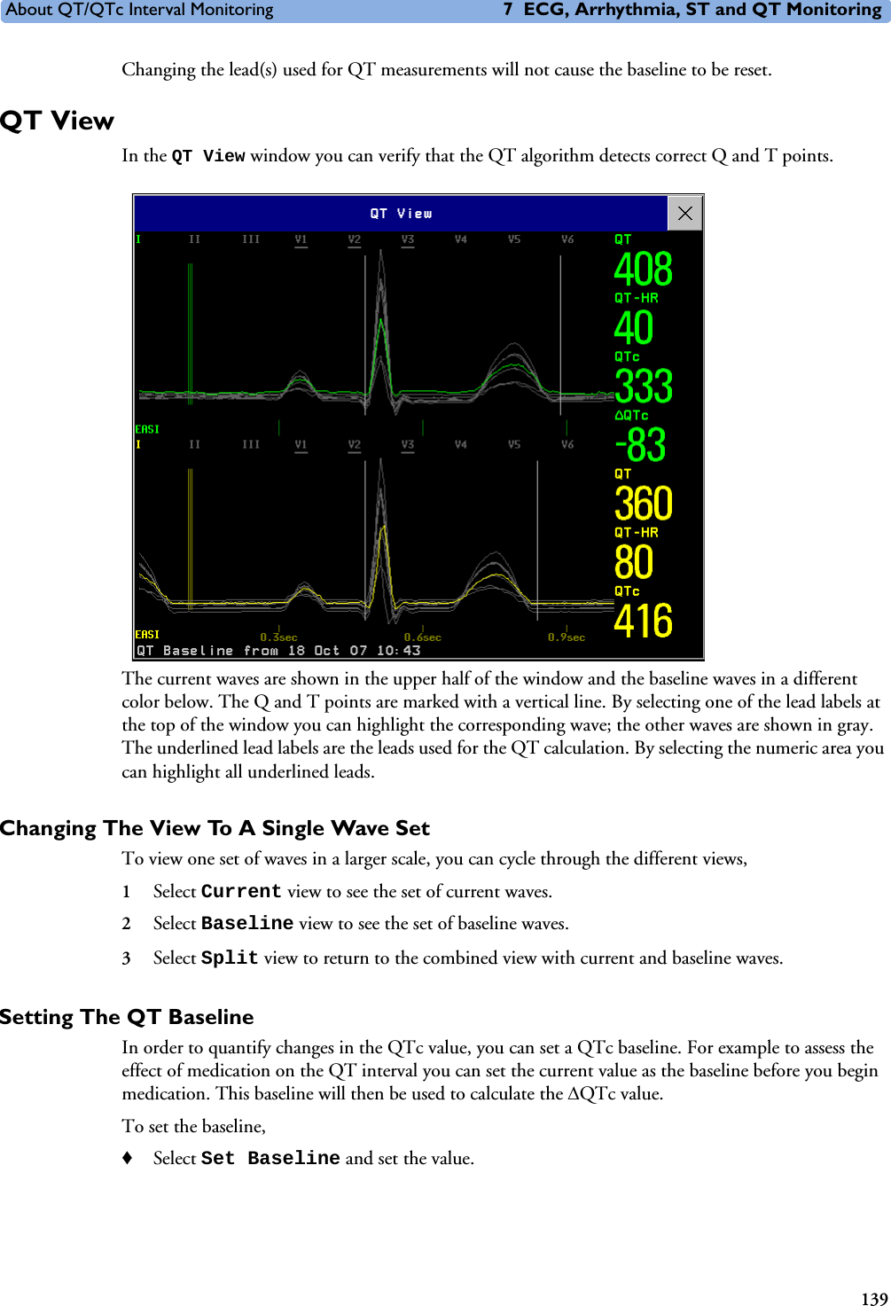 About QT/QTc Interval Monitoring 7 ECG, Arrhythmia, ST and QT Monitoring139Changing the lead(s) used for QT measurements will not cause the baseline to be reset. QT ViewIn the QT View window you can verify that the QT algorithm detects correct Q and T points. The current waves are shown in the upper half of the window and the baseline waves in a different color below. The Q and T points are marked with a vertical line. By selecting one of the lead labels at the top of the window you can highlight the corresponding wave; the other waves are shown in gray. The underlined lead labels are the leads used for the QT calculation. By selecting the numeric area you can highlight all underlined leads. Changing The View To A Single Wave SetTo view one set of waves in a larger scale, you can cycle through the different views, 1Select Current view to see the set of current waves.2Select Baseline view to see the set of baseline waves. 3Select Split view to return to the combined view with current and baseline waves. Setting The QT BaselineIn order to quantify changes in the QTc value, you can set a QTc baseline. For example to assess the effect of medication on the QT interval you can set the current value as the baseline before you begin medication. This baseline will then be used to calculate the QTc value. To set the baseline, ♦Select Set Baseline and set the value. 