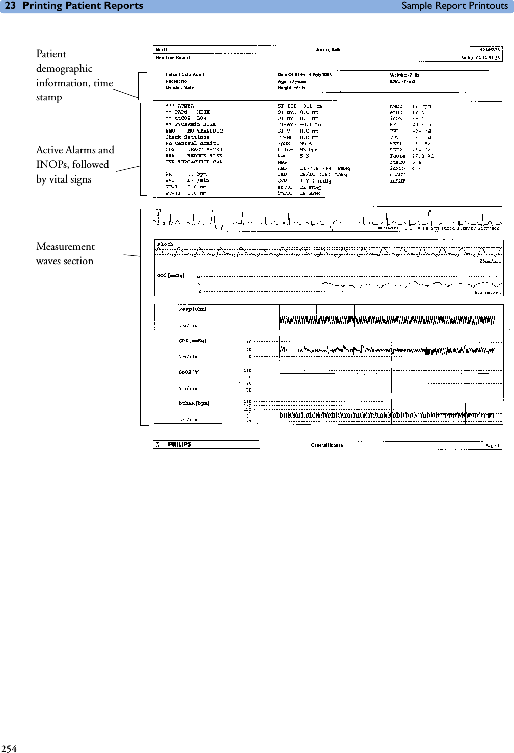 23 Printing Patient Reports Sample Report Printouts254Patient demographic information, time stampActive Alarms and INOPs, followed by vital signsMeasurement waves section 