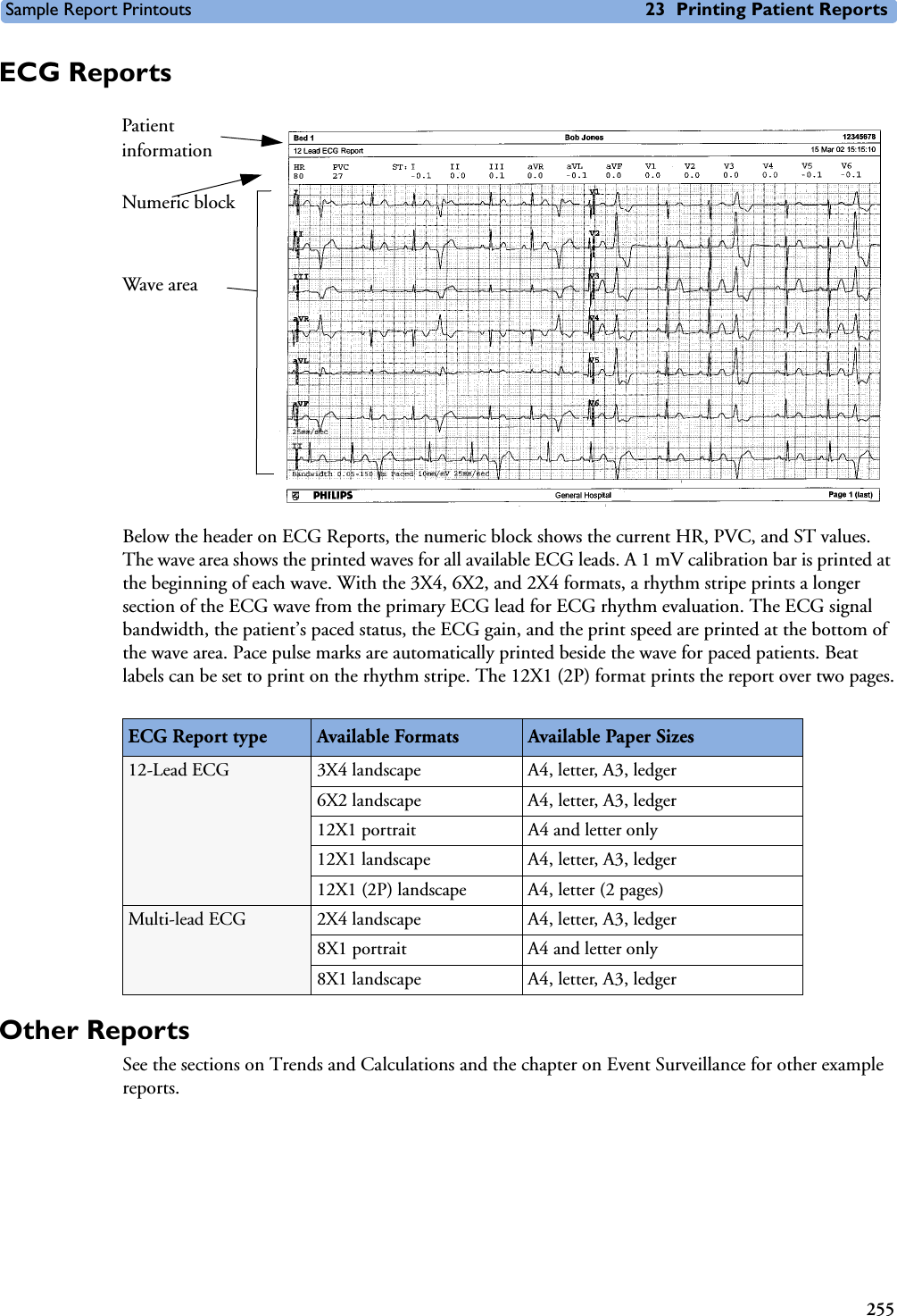 Sample Report Printouts 23 Printing Patient Reports255ECG ReportsBelow the header on ECG Reports, the numeric block shows the current HR, PVC, and ST values. The wave area shows the printed waves for all available ECG leads. A 1 mV calibration bar is printed at the beginning of each wave. With the 3X4, 6X2, and 2X4 formats, a rhythm stripe prints a longer section of the ECG wave from the primary ECG lead for ECG rhythm evaluation. The ECG signal bandwidth, the patient’s paced status, the ECG gain, and the print speed are printed at the bottom of the wave area. Pace pulse marks are automatically printed beside the wave for paced patients. Beat labels can be set to print on the rhythm stripe. The 12X1 (2P) format prints the report over two pages.Other ReportsSee the sections on Trends and Calculations and the chapter on Event Surveillance for other example reports.ECG Report type Available Formats Available Paper Sizes12-Lead ECG 3X4 landscape A4, letter, A3, ledger6X2 landscape A4, letter, A3, ledger12X1 portrait A4 and letter only12X1 landscape A4, letter, A3, ledger12X1 (2P) landscape A4, letter (2 pages)Multi-lead ECG 2X4 landscape A4, letter, A3, ledger8X1 portrait A4 and letter only8X1 landscape A4, letter, A3, ledgerPatient informationNumeric blockWave area