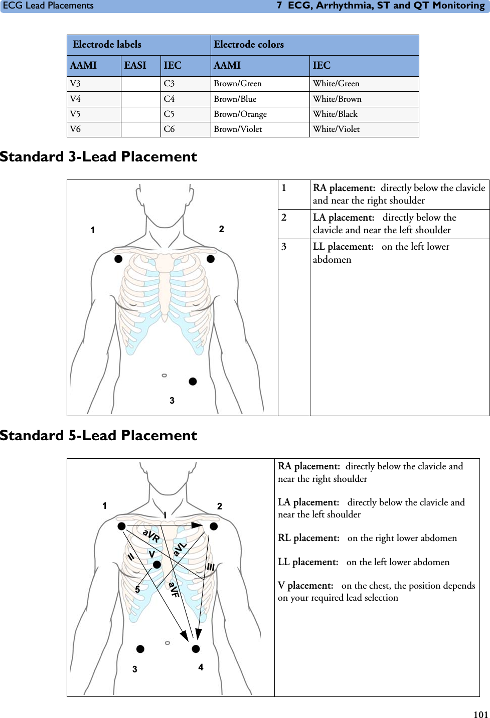 ECG Lead Placements 7 ECG, Arrhythmia, ST and QT Monitoring101Standard 3-Lead PlacementStandard 5-Lead PlacementV3 C3 Brown/Green White/GreenV4 C4 Brown/Blue White/BrownV5 C5 Brown/Orange White/BlackV6 C6 Brown/Violet White/Violet Electrode labels Electrode colorsAAMI EASI  IEC AAMI IEC1 RA placement: directly below the clavicle and near the right shoulder2 LA placement:  directly below the clavicle and near the left shoulder3 LL placement:  on the left lower abdomen123RA placement: directly below the clavicle and near the right shoulderLA placement:  directly below the clavicle and near the left shoulderRL placement:  on the right lower abdomenLL placement:  on the left lower abdomenV placement:  on the chest, the position depends on your required lead selection2 4 1V 3 IIIIIIaVRaVLaVF5