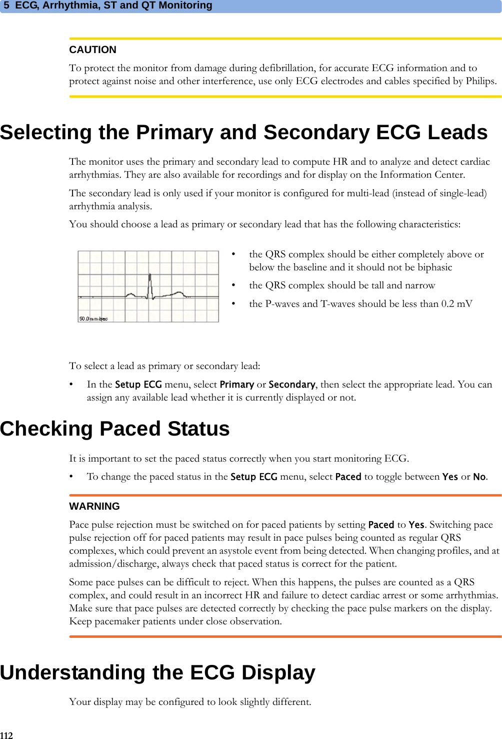 5 ECG, Arrhythmia, ST and QT Monitoring112CAUTIONTo protect the monitor from damage during defibrillation, for accurate ECG information and to protect against noise and other interference, use only ECG electrodes and cables specified by Philips.Selecting the Primary and Secondary ECG LeadsThe monitor uses the primary and secondary lead to compute HR and to analyze and detect cardiac arrhythmias. They are also available for recordings and for display on the Information Center.The secondary lead is only used if your monitor is configured for multi-lead (instead of single-lead) arrhythmia analysis.You should choose a lead as primary or secondary lead that has the following characteristics:To select a lead as primary or secondary lead:•In the Setup ECG menu, select Primary or Secondary, then select the appropriate lead. You can assign any available lead whether it is currently displayed or not.Checking Paced StatusIt is important to set the paced status correctly when you start monitoring ECG.• To change the paced status in the Setup ECG menu, select Paced to toggle between Yes or No.WARNINGPace pulse rejection must be switched on for paced patients by setting Paced to Yes. Switching pace pulse rejection off for paced patients may result in pace pulses being counted as regular QRS complexes, which could prevent an asystole event from being detected. When changing profiles, and at admission/discharge, always check that paced status is correct for the patient.Some pace pulses can be difficult to reject. When this happens, the pulses are counted as a QRS complex, and could result in an incorrect HR and failure to detect cardiac arrest or some arrhythmias. Make sure that pace pulses are detected correctly by checking the pace pulse markers on the display. Keep pacemaker patients under close observation.Understanding the ECG DisplayYour display may be configured to look slightly different.• the QRS complex should be either completely above or below the baseline and it should not be biphasic• the QRS complex should be tall and narrow• the P-waves and T-waves should be less than 0.2 mV