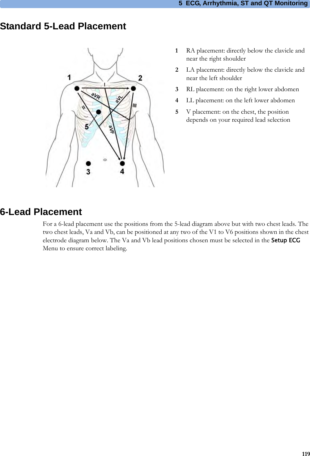 5 ECG, Arrhythmia, ST and QT Monitoring119Standard 5-Lead Placement6-Lead PlacementFor a 6-lead placement use the positions from the 5-lead diagram above but with two chest leads. The two chest leads, Va and Vb, can be positioned at any two of the V1 to V6 positions shown in the chest electrode diagram below. The Va and Vb lead positions chosen must be selected in the Setup ECG Menu to ensure correct labeling.1RA placement: directly below the clavicle and near the right shoulder2LA placement: directly below the clavicle and near the left shoulder3RL placement: on the right lower abdomen4LL placement: on the left lower abdomen5V placement: on the chest, the position depends on your required lead selection