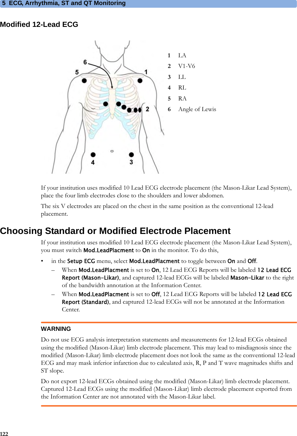 5 ECG, Arrhythmia, ST and QT Monitoring122Modified 12-Lead ECGIf your institution uses modified 10 Lead ECG electrode placement (the Mason-Likar Lead System), place the four limb electrodes close to the shoulders and lower abdomen.The six V electrodes are placed on the chest in the same position as the conventional 12-lead placement.Choosing Standard or Modified Electrode PlacementIf your institution uses modified 10 Lead ECG electrode placement (the Mason-Likar Lead System), you must switch Mod.LeadPlacment to On in the monitor. To do this,•in the Setup ECG menu, select Mod.LeadPlacment to toggle between On and Off.– When Mod.LeadPlacment is set to On, 12 Lead ECG Reports will be labeled 12 Lead ECG Report (Mason-Likar), and captured 12-lead ECGs will be labeled Mason-Likar to the right of the bandwidth annotation at the Information Center.– When Mod.LeadPlacment is set to Off, 12 Lead ECG Reports will be labeled 12 Lead ECG Report (Standard), and captured 12-lead ECGs will not be annotated at the Information Center.WARNINGDo not use ECG analysis interpretation statements and measurements for 12-lead ECGs obtained using the modified (Mason-Likar) limb electrode placement. This may lead to misdiagnosis since the modified (Mason-Likar) limb electrode placement does not look the same as the conventional 12-lead ECG and may mask inferior infarction due to calculated axis, R, P and T wave magnitudes shifts and ST slope.Do not export 12-lead ECGs obtained using the modified (Mason-Likar) limb electrode placement. Captured 12-Lead ECGs using the modified (Mason-Likar) limb electrode placement exported from the Information Center are not annotated with the Mason-Likar label.1LA2V1-V63LL4RL5RA6Angle of Lewis