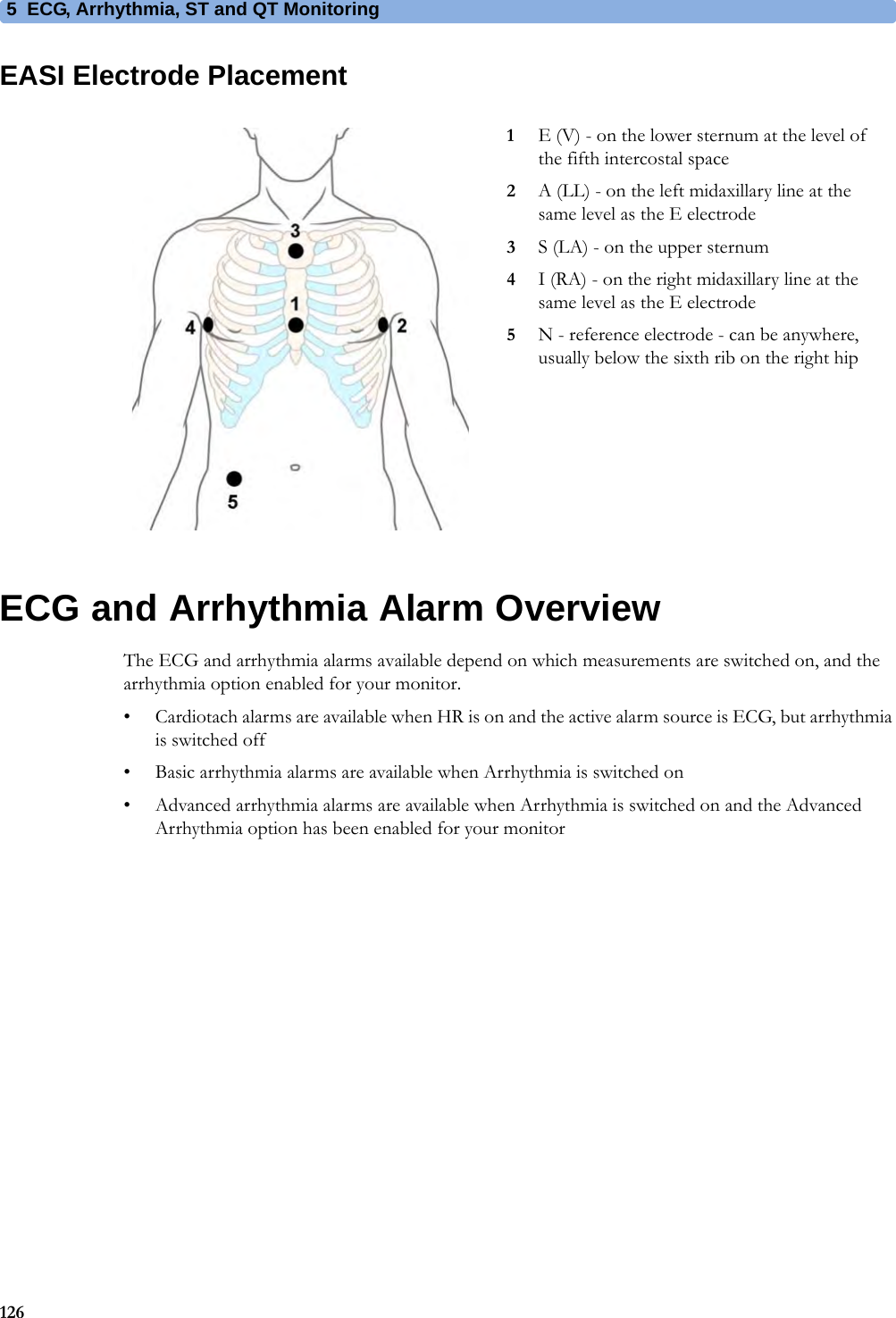 5 ECG, Arrhythmia, ST and QT Monitoring126EASI Electrode PlacementECG and Arrhythmia Alarm OverviewThe ECG and arrhythmia alarms available depend on which measurements are switched on, and the arrhythmia option enabled for your monitor.• Cardiotach alarms are available when HR is on and the active alarm source is ECG, but arrhythmia is switched off• Basic arrhythmia alarms are available when Arrhythmia is switched on• Advanced arrhythmia alarms are available when Arrhythmia is switched on and the Advanced Arrhythmia option has been enabled for your monitor1E (V) - on the lower sternum at the level of the fifth intercostal space2A (LL) - on the left midaxillary line at the same level as the E electrode3S (LA) - on the upper sternum4I (RA) - on the right midaxillary line at the same level as the E electrode5N - reference electrode - can be anywhere, usually below the sixth rib on the right hip