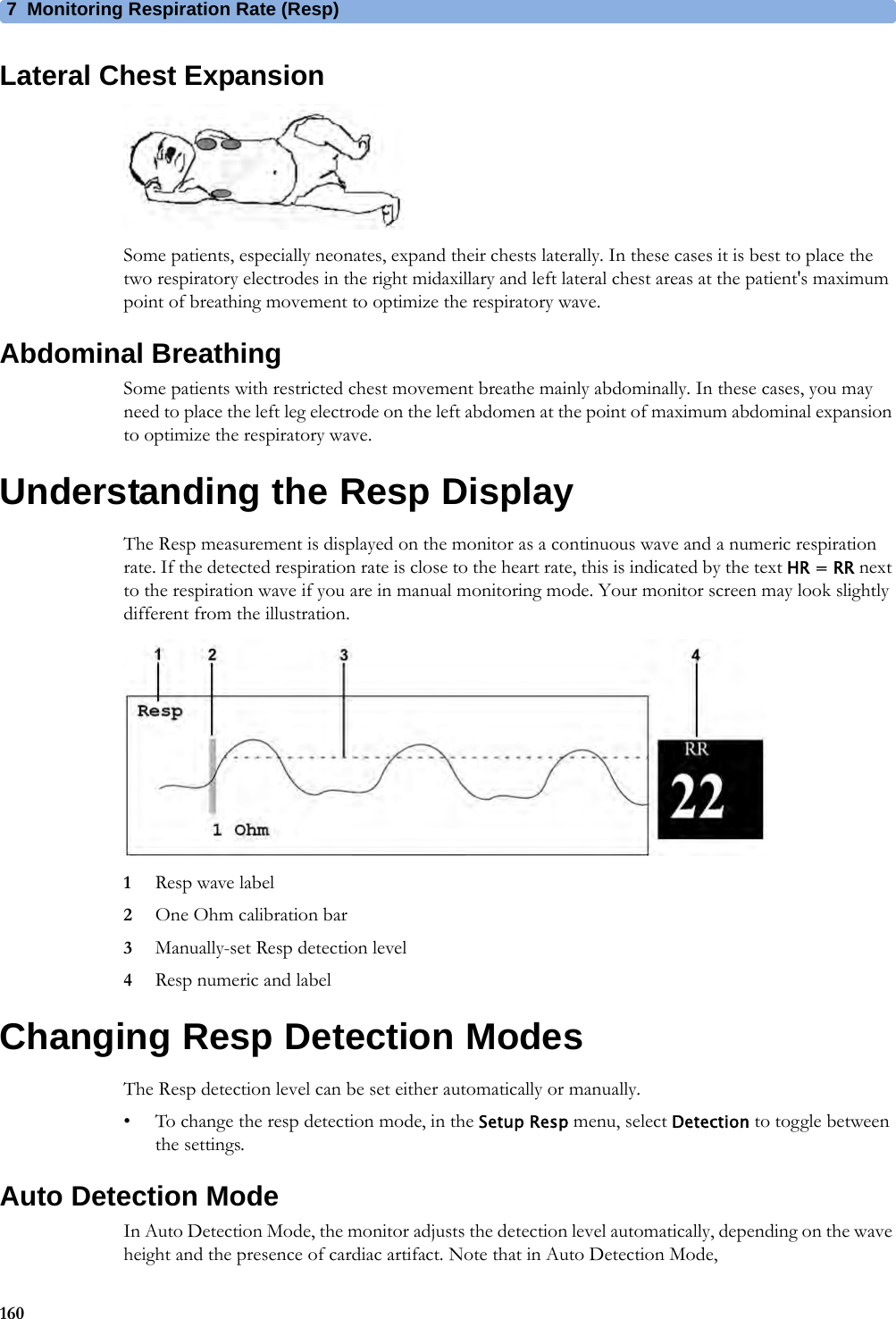 7 Monitoring Respiration Rate (Resp)160Lateral Chest ExpansionSome patients, especially neonates, expand their chests laterally. In these cases it is best to place the two respiratory electrodes in the right midaxillary and left lateral chest areas at the patient&apos;s maximum point of breathing movement to optimize the respiratory wave.Abdominal BreathingSome patients with restricted chest movement breathe mainly abdominally. In these cases, you may need to place the left leg electrode on the left abdomen at the point of maximum abdominal expansion to optimize the respiratory wave.Understanding the Resp DisplayThe Resp measurement is displayed on the monitor as a continuous wave and a numeric respiration rate. If the detected respiration rate is close to the heart rate, this is indicated by the text HR = RR next to the respiration wave if you are in manual monitoring mode. Your monitor screen may look slightly different from the illustration.1Resp wave label2One Ohm calibration bar3Manually-set Resp detection level4Resp numeric and labelChanging Resp Detection ModesThe Resp detection level can be set either automatically or manually.• To change the resp detection mode, in the Setup Resp menu, select Detection to toggle between the settings.Auto Detection ModeIn Auto Detection Mode, the monitor adjusts the detection level automatically, depending on the wave height and the presence of cardiac artifact. Note that in Auto Detection Mode,