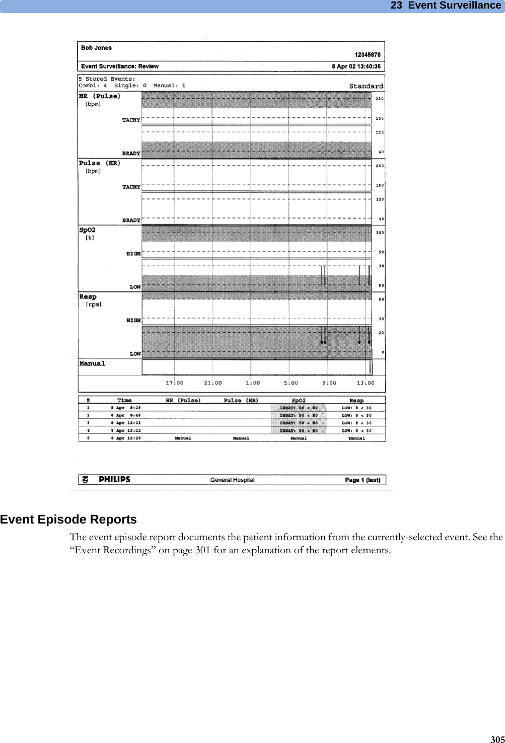 23 Event Surveillance305Event Episode ReportsThe event episode report documents the patient information from the currently-selected event. See the “Event Recordings” on page 301 for an explanation of the report elements.
