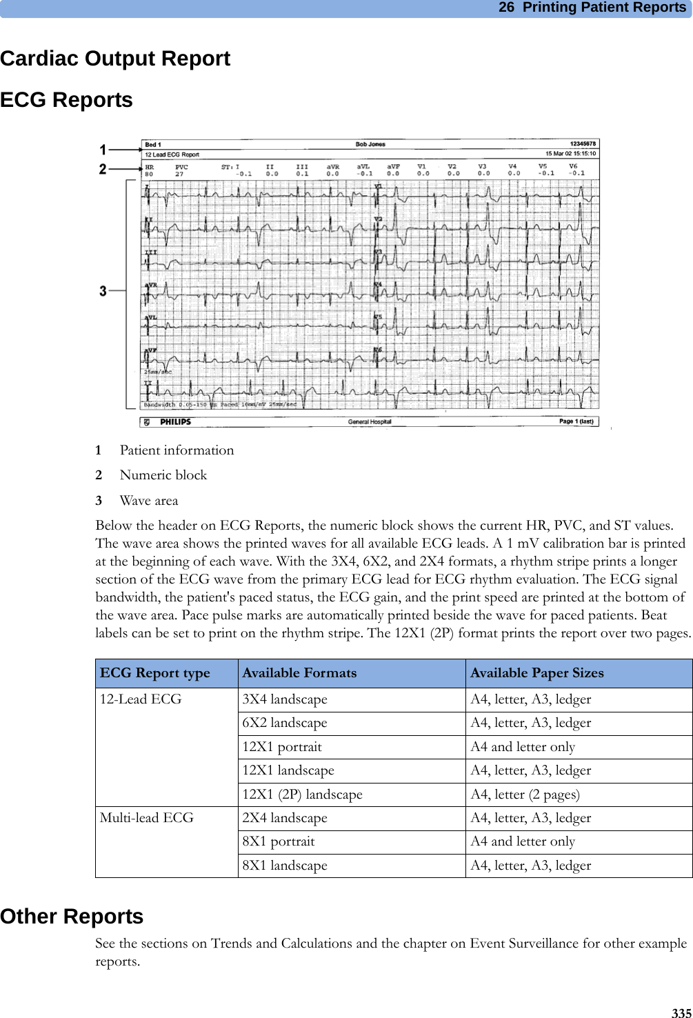26 Printing Patient Reports335Cardiac Output ReportECG Reports1Patient information2Numeric block3Wave areaBelow the header on ECG Reports, the numeric block shows the current HR, PVC, and ST values. The wave area shows the printed waves for all available ECG leads. A 1 mV calibration bar is printed at the beginning of each wave. With the 3X4, 6X2, and 2X4 formats, a rhythm stripe prints a longer section of the ECG wave from the primary ECG lead for ECG rhythm evaluation. The ECG signal bandwidth, the patient&apos;s paced status, the ECG gain, and the print speed are printed at the bottom of the wave area. Pace pulse marks are automatically printed beside the wave for paced patients. Beat labels can be set to print on the rhythm stripe. The 12X1 (2P) format prints the report over two pages.Other ReportsSee the sections on Trends and Calculations and the chapter on Event Surveillance for other example reports.ECG Report type Available Formats Available Paper Sizes12-Lead ECG 3X4 landscape A4, letter, A3, ledger6X2 landscape A4, letter, A3, ledger12X1 portrait A4 and letter only12X1 landscape A4, letter, A3, ledger12X1 (2P) landscape A4, letter (2 pages)Multi-lead ECG 2X4 landscape A4, letter, A3, ledger8X1 portrait A4 and letter only8X1 landscape A4, letter, A3, ledger