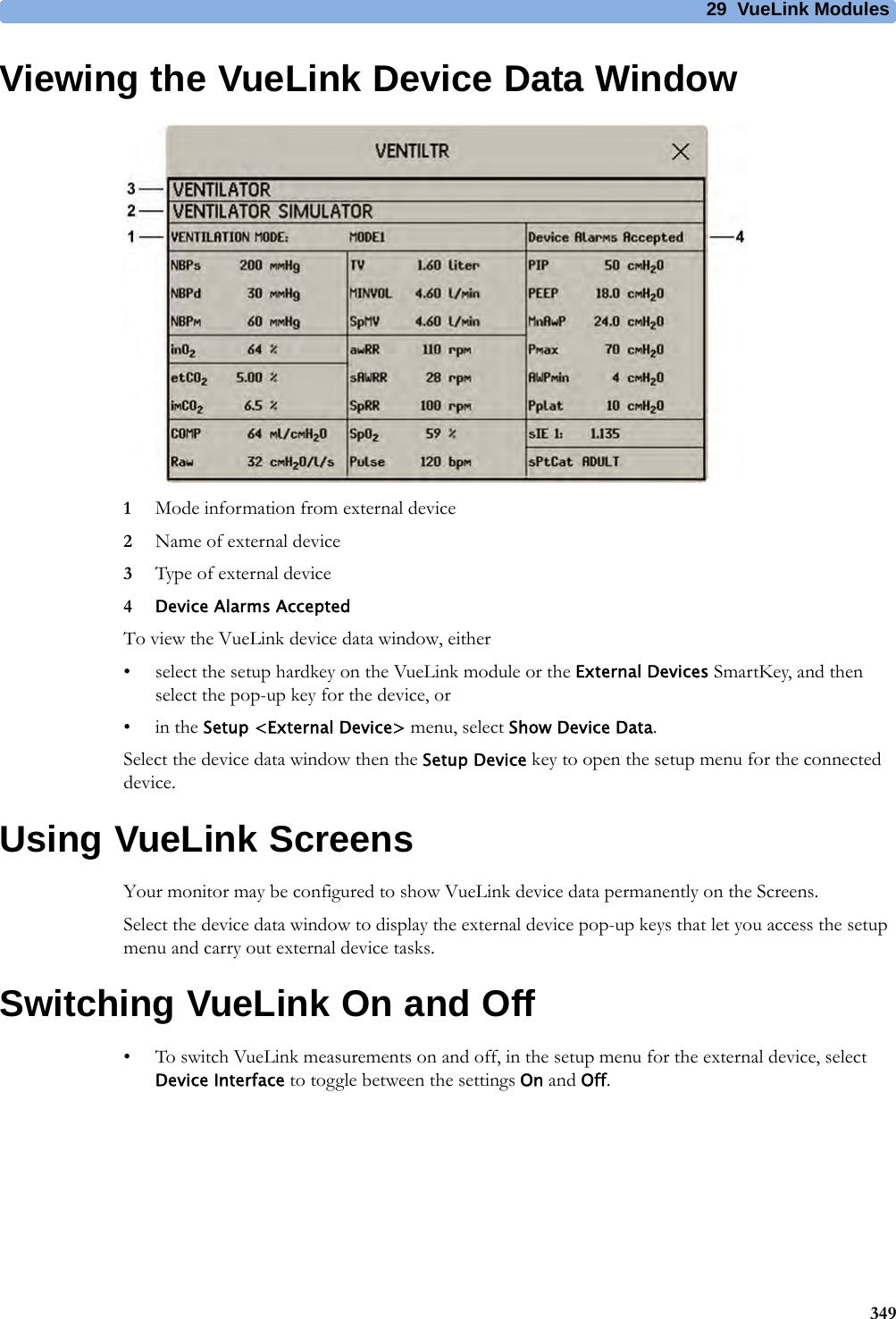29 VueLink Modules349Viewing the VueLink Device Data Window1Mode information from external device2Name of external device3Type of external device4Device Alarms AcceptedTo view the VueLink device data window, either• select the setup hardkey on the VueLink module or the External Devices SmartKey, and then select the pop-up key for the device, or•in the Setup &lt;External Device&gt; menu, select Show Device Data.Select the device data window then the Setup Device key to open the setup menu for the connected device.Using VueLink ScreensYour monitor may be configured to show VueLink device data permanently on the Screens.Select the device data window to display the external device pop-up keys that let you access the setup menu and carry out external device tasks.Switching VueLink On and Off• To switch VueLink measurements on and off, in the setup menu for the external device, select Device Interface to toggle between the settings On and Off.