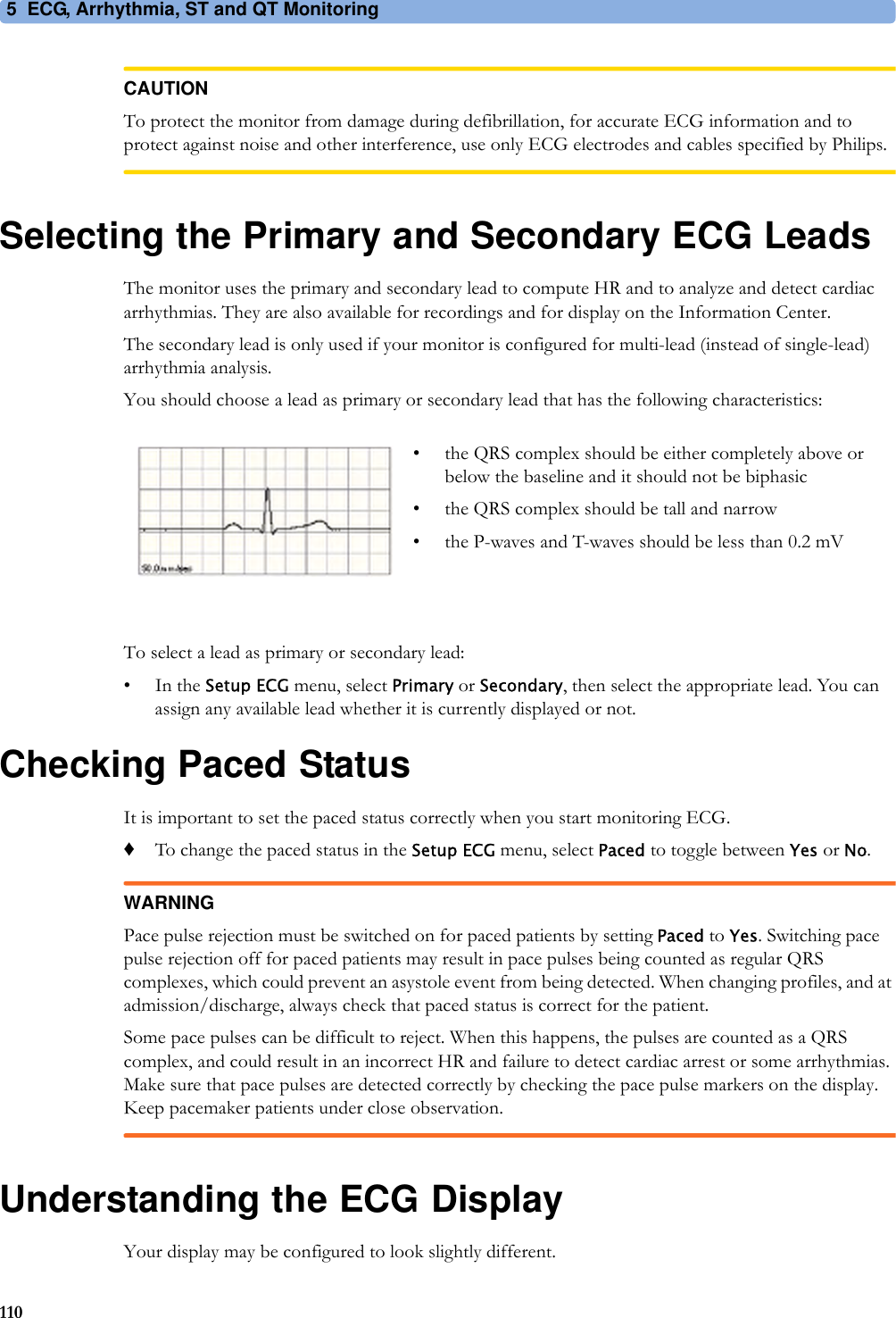 5 ECG, Arrhythmia, ST and QT Monitoring110CAUTIONTo protect the monitor from damage during defibrillation, for accurate ECG information and to protect against noise and other interference, use only ECG electrodes and cables specified by Philips.Selecting the Primary and Secondary ECG LeadsThe monitor uses the primary and secondary lead to compute HR and to analyze and detect cardiac arrhythmias. They are also available for recordings and for display on the Information Center.The secondary lead is only used if your monitor is configured for multi-lead (instead of single-lead) arrhythmia analysis.You should choose a lead as primary or secondary lead that has the following characteristics:To select a lead as primary or secondary lead:•In the Setup ECG menu, select Primary or Secondary, then select the appropriate lead. You can assign any available lead whether it is currently displayed or not.Checking Paced StatusIt is important to set the paced status correctly when you start monitoring ECG.♦To change the paced status in the Setup ECG menu, select Paced to toggle between Yes or No.WARNINGPace pulse rejection must be switched on for paced patients by setting Paced to Yes. Switching pace pulse rejection off for paced patients may result in pace pulses being counted as regular QRS complexes, which could prevent an asystole event from being detected. When changing profiles, and at admission/discharge, always check that paced status is correct for the patient.Some pace pulses can be difficult to reject. When this happens, the pulses are counted as a QRS complex, and could result in an incorrect HR and failure to detect cardiac arrest or some arrhythmias. Make sure that pace pulses are detected correctly by checking the pace pulse markers on the display. Keep pacemaker patients under close observation.Understanding the ECG DisplayYour display may be configured to look slightly different.• the QRS complex should be either completely above or below the baseline and it should not be biphasic• the QRS complex should be tall and narrow• the P-waves and T-waves should be less than 0.2 mV