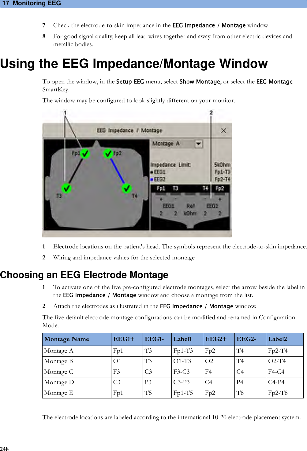 17 Monitoring EEG2487Check the electrode-to-skin impedance in the EEG Impedance / Montage window.8For good signal quality, keep all lead wires together and away from other electric devices and metallic bodies.Using the EEG Impedance/Montage WindowTo open the window, in the Setup EEG menu, select Show Montage, or select the EEG Montage SmartKey.The window may be configured to look slightly different on your monitor.1Electrode locations on the patient&apos;s head. The symbols represent the electrode-to-skin impedance.2Wiring and impedance values for the selected montageChoosing an EEG Electrode Montage1To activate one of the five pre-configured electrode montages, select the arrow beside the label in the EEG Impedance / Montage window and choose a montage from the list.2Attach the electrodes as illustrated in the EEG Impedance / Montage window.The five default electrode montage configurations can be modified and renamed in Configuration Mode.The electrode locations are labeled according to the international 10-20 electrode placement system.Montage Name EEG1+ EEG1- Label1 EEG2+ EEG2- Label2Montage A Fp1 T3 Fp1-T3 Fp2 T4 Fp2-T4Montage B O1 T3 O1-T3 O2 T4 O2-T4Montage C F3 C3 F3-C3 F4 C4 F4-C4Montage D C3 P3 C3-P3 C4 P4 C4-P4Montage E Fp1 T5 Fp1-T5 Fp2 T6 Fp2-T6