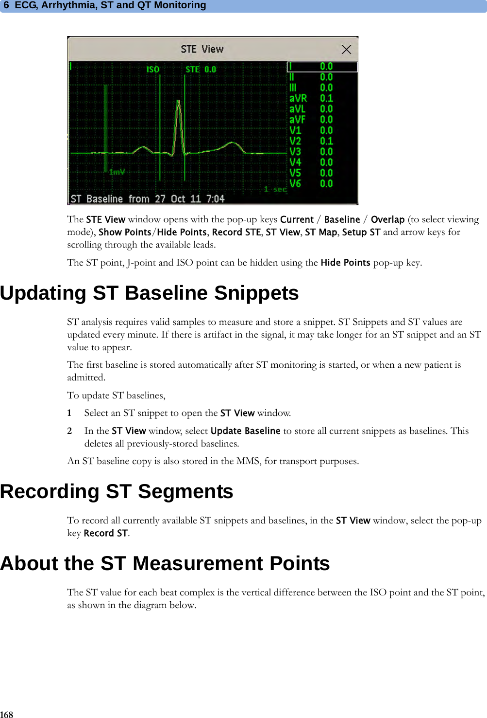 6 ECG, Arrhythmia, ST and QT Monitoring168The STE View window opens with the pop-up keys Current / Baseline / Overlap (to select viewing mode), Show Points/Hide Points, Record STE, ST View, ST Map, Setup ST and arrow keys for scrolling through the available leads.The ST point, J-point and ISO point can be hidden using the Hide Points pop-up key.Updating ST Baseline SnippetsST analysis requires valid samples to measure and store a snippet. ST Snippets and ST values are updated every minute. If there is artifact in the signal, it may take longer for an ST snippet and an ST value to appear.The first baseline is stored automatically after ST monitoring is started, or when a new patient is admitted.To update ST baselines,1Select an ST snippet to open the ST View window.2In the ST View window, select Update Baseline to store all current snippets as baselines. This deletes all previously-stored baselines.An ST baseline copy is also stored in the MMS, for transport purposes.Recording ST SegmentsTo record all currently available ST snippets and baselines, in the ST View window, select the pop-up key Record ST.About the ST Measurement PointsThe ST value for each beat complex is the vertical difference between the ISO point and the ST point, as shown in the diagram below. 