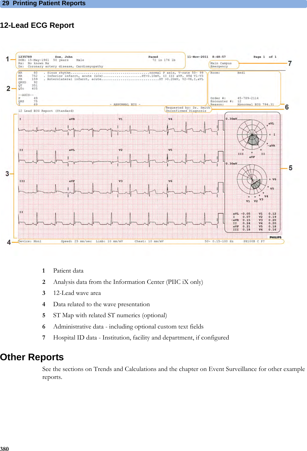 29 Printing Patient Reports38012-Lead ECG Report1Patient data2Analysis data from the Information Center (PIIC iX only)312-Lead wave area4Data related to the wave presentation5ST Map with related ST numerics (optional)6Administrative data - including optional custom text fields7Hospital ID data - Institution, facility and department, if configuredOther ReportsSee the sections on Trends and Calculations and the chapter on Event Surveillance for other example reports.