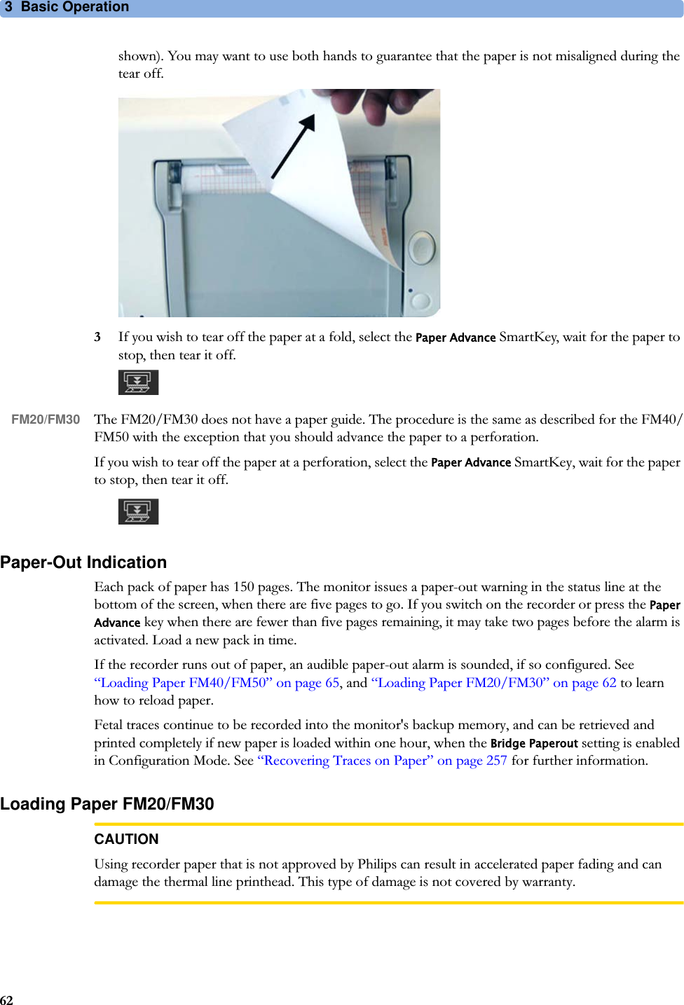 3  Basic Operation62shown). You may want to use both hands to guarantee that the paper is not misaligned during the tear off.3If you wish to tear off the paper at a fold, select the Paper Advance SmartKey, wait for the paper to stop, then tear it off.FM20/FM30 The FM20/FM30 does not have a paper guide. The procedure is the same as described for the FM40/FM50 with the exception that you should advance the paper to a perforation.If you wish to tear off the paper at a perforation, select the Paper Advance SmartKey, wait for the paper to stop, then tear it off.Paper-Out IndicationEach pack of paper has 150 pages. The monitor issues a paper-out warning in the status line at the bottom of the screen, when there are five pages to go. If you switch on the recorder or press the Paper Advance key when there are fewer than five pages remaining, it may take two pages before the alarm is activated. Load a new pack in time.If the recorder runs out of paper, an audible paper-out alarm is sounded, if so configured. See “Loading Paper FM40/FM50” on page 65, and “Loading Paper FM20/FM30” on page 62 to learn how to reload paper.Fetal traces continue to be recorded into the monitor&apos;s backup memory, and can be retrieved and printed completely if new paper is loaded within one hour, when the Bridge Paperout setting is enabled in Configuration Mode. See “Recovering Traces on Paper” on page 257 for further information.Loading Paper FM20/FM30CAUTIONUsing recorder paper that is not approved by Philips can result in accelerated paper fading and can damage the thermal line printhead. This type of damage is not covered by warranty.