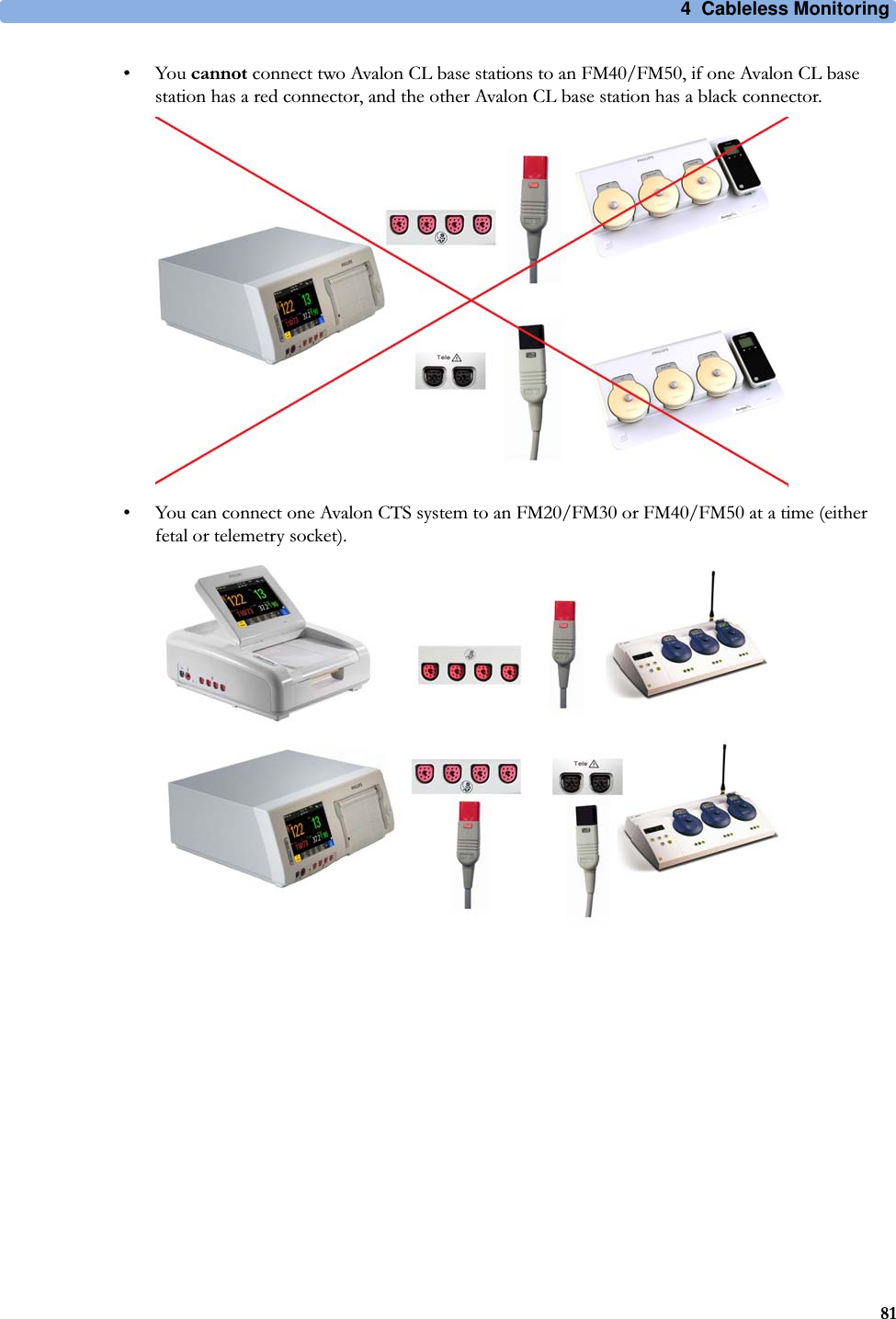 4  Cableless Monitoring81•You cannot connect two Avalon CL base stations to an FM40/FM50, if one Avalon CL base station has a red connector, and the other Avalon CL base station has a black connector.• You can connect one Avalon CTS system to an FM20/FM30 or FM40/FM50 at a time (either fetal or telemetry socket).