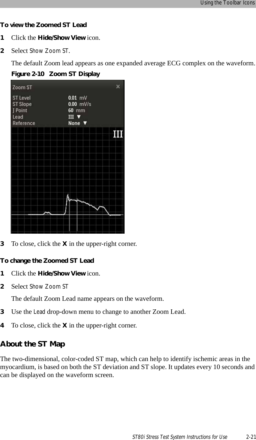Using the Toolbar IconsST80i Stress Test System Instructions for Use 2-21To view the Zoomed ST Lead1Click the Hide/Show View icon.2Select Show Zoom ST.The default Zoom lead appears as one expanded average ECG complex on the waveform.Figure 2-10 Zoom ST Display3To close, click the X in the upper-right corner.To change the Zoomed ST Lead1Click the Hide/Show View icon.2Select Show Zoom STThe default Zoom Lead name appears on the waveform.3Use the Lead drop-down menu to change to another Zoom Lead.4To close, click the X in the upper-right corner.About the ST MapThe two-dimensional, color-coded ST map, which can help to identify ischemic areas in the myocardium, is based on both the ST deviation and ST slope. It updates every 10 seconds and can be displayed on the waveform screen.