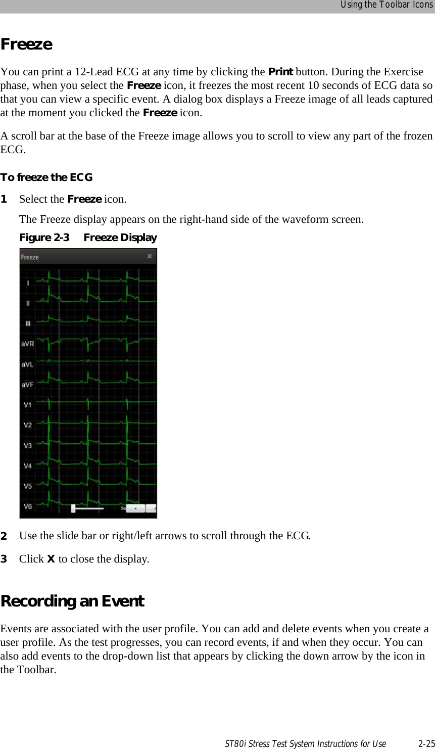 Using the Toolbar IconsST80i Stress Test System Instructions for Use 2-25FreezeYou can print a 12-Lead ECG at any time by clicking the Print button. During the Exercise phase, when you select the Freeze icon, it freezes the most recent 10 seconds of ECG data so that you can view a specific event. A dialog box displays a Freeze image of all leads captured at the moment you clicked the Freeze icon.A scroll bar at the base of the Freeze image allows you to scroll to view any part of the frozen ECG. To freeze the ECG1Select the Freeze icon.The Freeze display appears on the right-hand side of the waveform screen.Figure 2-3 Freeze Display2Use the slide bar or right/left arrows to scroll through the ECG.3Click X to close the display.Recording an Event Events are associated with the user profile. You can add and delete events when you create a user profile. As the test progresses, you can record events, if and when they occur. You can also add events to the drop-down list that appears by clicking the down arrow by the icon in the Toolbar.