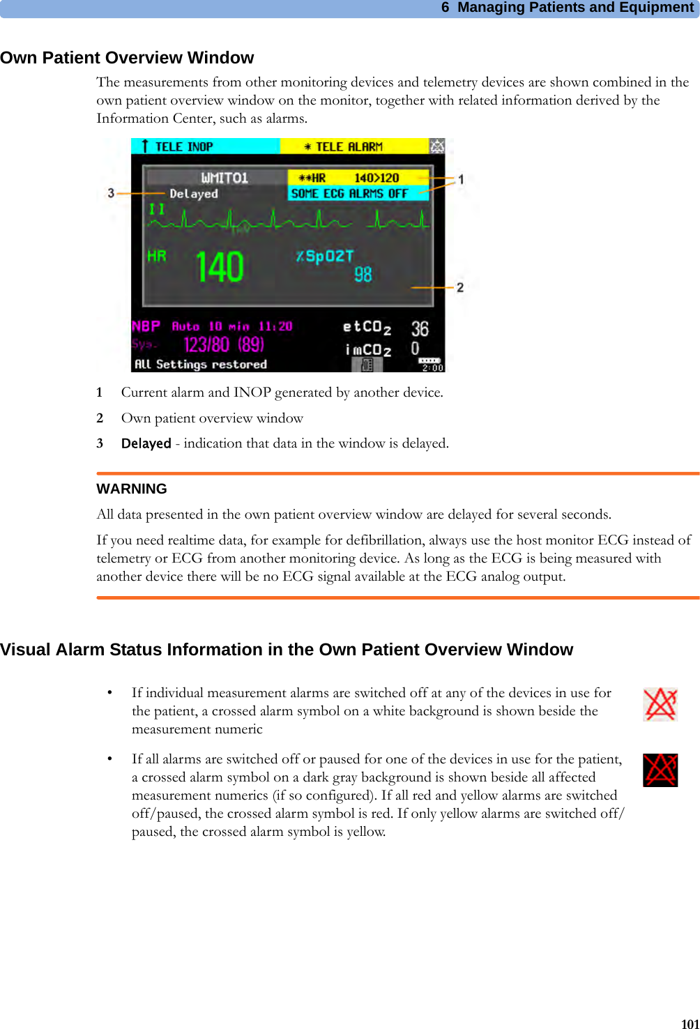 6 Managing Patients and Equipment101Own Patient Overview WindowThe measurements from other monitoring devices and telemetry devices are shown combined in the own patient overview window on the monitor, together with related information derived by the Information Center, such as alarms.1Current alarm and INOP generated by another device.2Own patient overview window3Delayed - indication that data in the window is delayed.WARNINGAll data presented in the own patient overview window are delayed for several seconds.If you need realtime data, for example for defibrillation, always use the host monitor ECG instead of telemetry or ECG from another monitoring device. As long as the ECG is being measured with another device there will be no ECG signal available at the ECG analog output.Visual Alarm Status Information in the Own Patient Overview Window• If individual measurement alarms are switched off at any of the devices in use for the patient, a crossed alarm symbol on a white background is shown beside the measurement numeric• If all alarms are switched off or paused for one of the devices in use for the patient, a crossed alarm symbol on a dark gray background is shown beside all affected measurement numerics (if so configured). If all red and yellow alarms are switched off/paused, the crossed alarm symbol is red. If only yellow alarms are switched off/paused, the crossed alarm symbol is yellow.