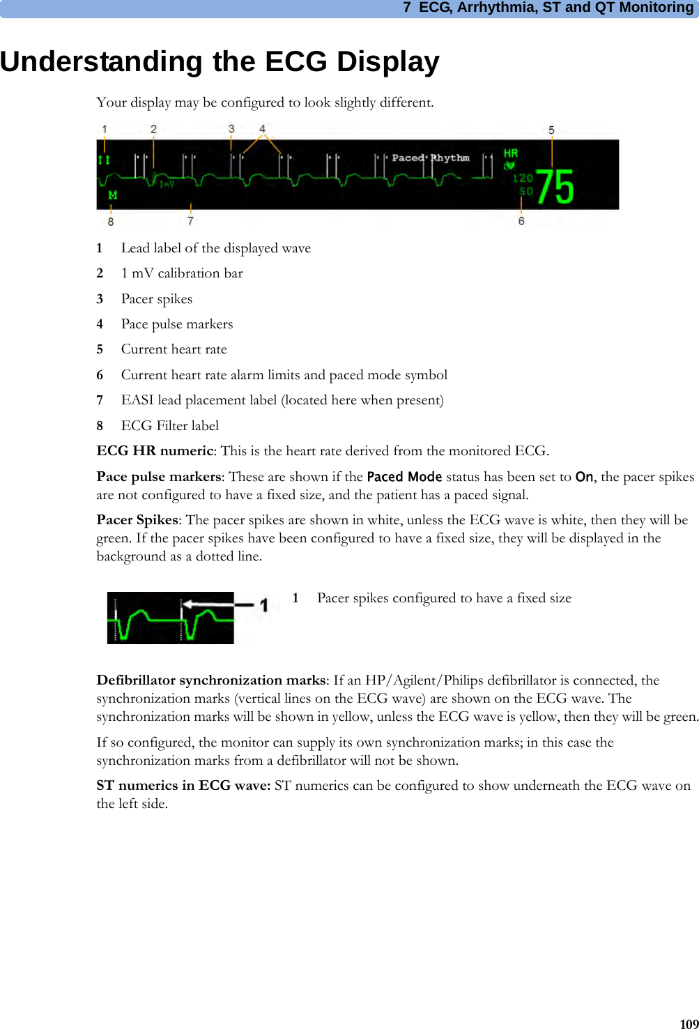 7 ECG, Arrhythmia, ST and QT Monitoring109Understanding the ECG DisplayYour display may be configured to look slightly different.1Lead label of the displayed wave21 mV calibration bar3Pacer spikes4Pace pulse markers5Current heart rate6Current heart rate alarm limits and paced mode symbol7EASI lead placement label (located here when present)8ECG Filter labelECG HR numeric: This is the heart rate derived from the monitored ECG.Pace pulse markers: These are shown if the Paced Mode status has been set to On, the pacer spikes are not configured to have a fixed size, and the patient has a paced signal.Pacer Spikes: The pacer spikes are shown in white, unless the ECG wave is white, then they will be green. If the pacer spikes have been configured to have a fixed size, they will be displayed in the background as a dotted line.Defibrillator synchronization marks: If an HP/Agilent/Philips defibrillator is connected, the synchronization marks (vertical lines on the ECG wave) are shown on the ECG wave. The synchronization marks will be shown in yellow, unless the ECG wave is yellow, then they will be green.If so configured, the monitor can supply its own synchronization marks; in this case the synchronization marks from a defibrillator will not be shown.ST numerics in ECG wave: ST numerics can be configured to show underneath the ECG wave on the left side.1Pacer spikes configured to have a fixed size