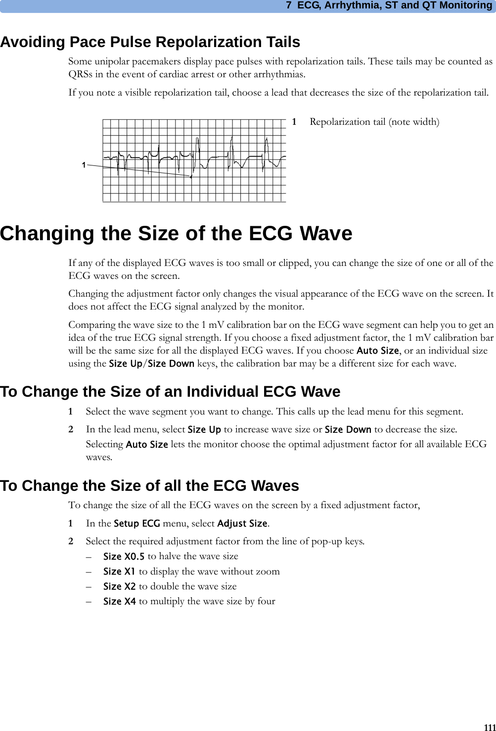 7 ECG, Arrhythmia, ST and QT Monitoring111Avoiding Pace Pulse Repolarization TailsSome unipolar pacemakers display pace pulses with repolarization tails. These tails may be counted as QRSs in the event of cardiac arrest or other arrhythmias.If you note a visible repolarization tail, choose a lead that decreases the size of the repolarization tail.Changing the Size of the ECG WaveIf any of the displayed ECG waves is too small or clipped, you can change the size of one or all of the ECG waves on the screen.Changing the adjustment factor only changes the visual appearance of the ECG wave on the screen. It does not affect the ECG signal analyzed by the monitor.Comparing the wave size to the 1 mV calibration bar on the ECG wave segment can help you to get an idea of the true ECG signal strength. If you choose a fixed adjustment factor, the 1 mV calibration bar will be the same size for all the displayed ECG waves. If you choose Auto Size, or an individual size using the Size Up/Size Down keys, the calibration bar may be a different size for each wave.To Change the Size of an Individual ECG Wave1Select the wave segment you want to change. This calls up the lead menu for this segment.2In the lead menu, select Size Up to increase wave size or Size Down to decrease the size.Selecting Auto Size lets the monitor choose the optimal adjustment factor for all available ECG waves.To Change the Size of all the ECG WavesTo change the size of all the ECG waves on the screen by a fixed adjustment factor,1In the Setup ECG menu, select Adjust Size.2Select the required adjustment factor from the line of pop-up keys.–Size X0.5 to halve the wave size–Size X1 to display the wave without zoom–Size X2 to double the wave size–Size X4 to multiply the wave size by four1Repolarization tail (note width)