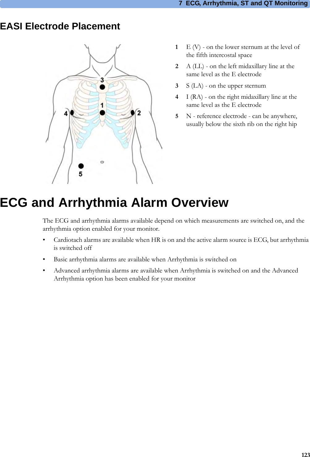 7 ECG, Arrhythmia, ST and QT Monitoring123EASI Electrode PlacementECG and Arrhythmia Alarm OverviewThe ECG and arrhythmia alarms available depend on which measurements are switched on, and the arrhythmia option enabled for your monitor.• Cardiotach alarms are available when HR is on and the active alarm source is ECG, but arrhythmia is switched off• Basic arrhythmia alarms are available when Arrhythmia is switched on• Advanced arrhythmia alarms are available when Arrhythmia is switched on and the Advanced Arrhythmia option has been enabled for your monitor1E (V) - on the lower sternum at the level of the fifth intercostal space2A (LL) - on the left midaxillary line at the same level as the E electrode3S (LA) - on the upper sternum4I (RA) - on the right midaxillary line at the same level as the E electrode5N - reference electrode - can be anywhere, usually below the sixth rib on the right hip