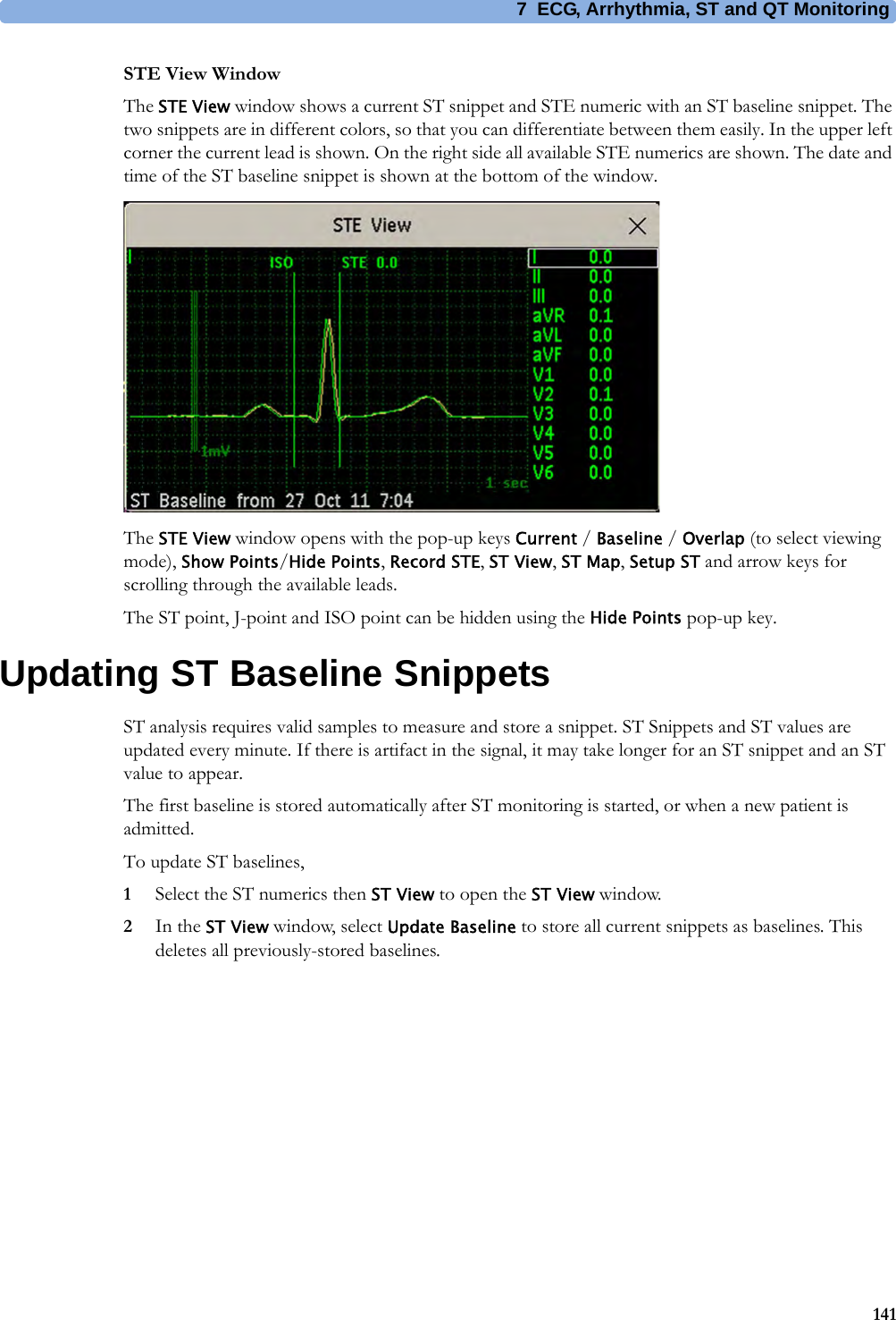 7 ECG, Arrhythmia, ST and QT Monitoring141STE View WindowThe STE View window shows a current ST snippet and STE numeric with an ST baseline snippet. The two snippets are in different colors, so that you can differentiate between them easily. In the upper left corner the current lead is shown. On the right side all available STE numerics are shown. The date and time of the ST baseline snippet is shown at the bottom of the window.The STE View window opens with the pop-up keys Current / Baseline / Overlap (to select viewing mode), Show Points/Hide Points, Record STE, ST View, ST Map, Setup ST and arrow keys for scrolling through the available leads.The ST point, J-point and ISO point can be hidden using the Hide Points pop-up key.Updating ST Baseline SnippetsST analysis requires valid samples to measure and store a snippet. ST Snippets and ST values are updated every minute. If there is artifact in the signal, it may take longer for an ST snippet and an ST value to appear.The first baseline is stored automatically after ST monitoring is started, or when a new patient is admitted.To update ST baselines,1Select the ST numerics then ST View to open the ST View window.2In the ST View window, select Update Baseline to store all current snippets as baselines. This deletes all previously-stored baselines.