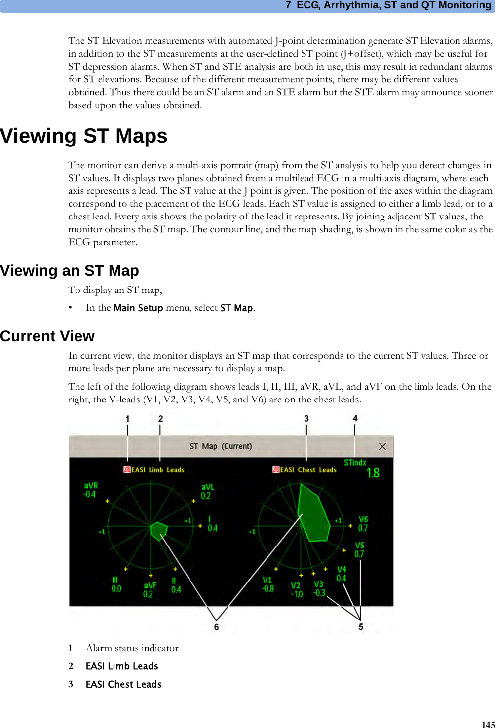 7 ECG, Arrhythmia, ST and QT Monitoring145The ST Elevation measurements with automated J-point determination generate ST Elevation alarms, in addition to the ST measurements at the user-defined ST point (J+offset), which may be useful for ST depression alarms. When ST and STE analysis are both in use, this may result in redundant alarms for ST elevations. Because of the different measurement points, there may be different values obtained. Thus there could be an ST alarm and an STE alarm but the STE alarm may announce sooner based upon the values obtained.Viewing ST MapsThe monitor can derive a multi-axis portrait (map) from the ST analysis to help you detect changes in ST values. It displays two planes obtained from a multilead ECG in a multi-axis diagram, where each axis represents a lead. The ST value at the J point is given. The position of the axes within the diagram correspond to the placement of the ECG leads. Each ST value is assigned to either a limb lead, or to a chest lead. Every axis shows the polarity of the lead it represents. By joining adjacent ST values, the monitor obtains the ST map. The contour line, and the map shading, is shown in the same color as the ECG parameter.Viewing an ST MapTo display an ST map,•In the Main Setup menu, select ST Map.Current ViewIn current view, the monitor displays an ST map that corresponds to the current ST values. Three or more leads per plane are necessary to display a map.The left of the following diagram shows leads I, II, III, aVR, aVL, and aVF on the limb leads. On the right, the V-leads (V1, V2, V3, V4, V5, and V6) are on the chest leads.1Alarm status indicator2EASI Limb Leads3EASI Chest Leads