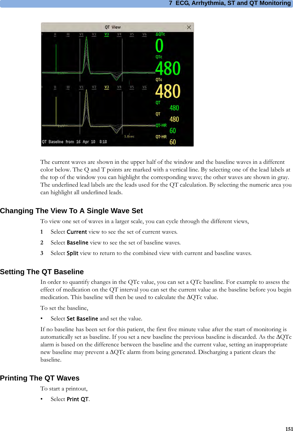 7 ECG, Arrhythmia, ST and QT Monitoring151The current waves are shown in the upper half of the window and the baseline waves in a different color below. The Q and T points are marked with a vertical line. By selecting one of the lead labels at the top of the window you can highlight the corresponding wave; the other waves are shown in gray. The underlined lead labels are the leads used for the QT calculation. By selecting the numeric area you can highlight all underlined leads.Changing The View To A Single Wave SetTo view one set of waves in a larger scale, you can cycle through the different views,1Select Current view to see the set of current waves.2Select Baseline view to see the set of baseline waves.3Select Split view to return to the combined view with current and baseline waves.Setting The QT BaselineIn order to quantify changes in the QTc value, you can set a QTc baseline. For example to assess the effect of medication on the QT interval you can set the current value as the baseline before you begin medication. This baseline will then be used to calculate the QTc value.To set the baseline,•Select Set Baseline and set the value.If no baseline has been set for this patient, the first five minute value after the start of monitoring is automatically set as baseline. If you set a new baseline the previous baseline is discarded. As the QTc alarm is based on the difference between the baseline and the current value, setting an inappropriate new baseline may prevent a QTc alarm from being generated. Discharging a patient clears the baseline.Printing The QT WavesTo start a printout,•Select Print QT.