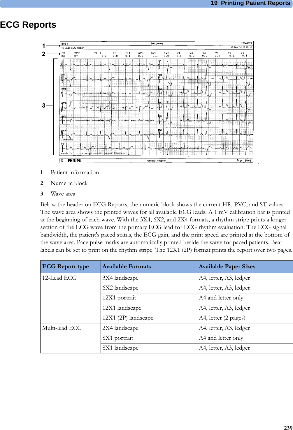 19 Printing Patient Reports239ECG Reports1Patient information2Numeric block3Wave areaBelow the header on ECG Reports, the numeric block shows the current HR, PVC, and ST values. The wave area shows the printed waves for all available ECG leads. A 1 mV calibration bar is printed at the beginning of each wave. With the 3X4, 6X2, and 2X4 formats, a rhythm stripe prints a longer section of the ECG wave from the primary ECG lead for ECG rhythm evaluation. The ECG signal bandwidth, the patient&apos;s paced status, the ECG gain, and the print speed are printed at the bottom of the wave area. Pace pulse marks are automatically printed beside the wave for paced patients. Beat labels can be set to print on the rhythm stripe. The 12X1 (2P) format prints the report over two pages.ECG Report type Available Formats Available Paper Sizes12-Lead ECG 3X4 landscape A4, letter, A3, ledger6X2 landscape A4, letter, A3, ledger12X1 portrait A4 and letter only12X1 landscape A4, letter, A3, ledger12X1 (2P) landscape A4, letter (2 pages)Multi-lead ECG 2X4 landscape A4, letter, A3, ledger8X1 portrait A4 and letter only8X1 landscape A4, letter, A3, ledger