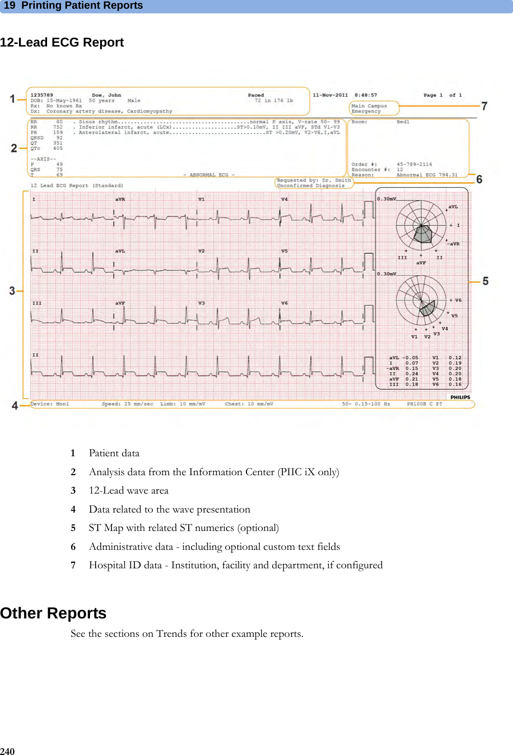 19 Printing Patient Reports24012-Lead ECG Report1Patient data2Analysis data from the Information Center (PIIC iX only)312-Lead wave area4Data related to the wave presentation5ST Map with related ST numerics (optional)6Administrative data - including optional custom text fields7Hospital ID data - Institution, facility and department, if configuredOther ReportsSee the sections on Trends for other example reports.