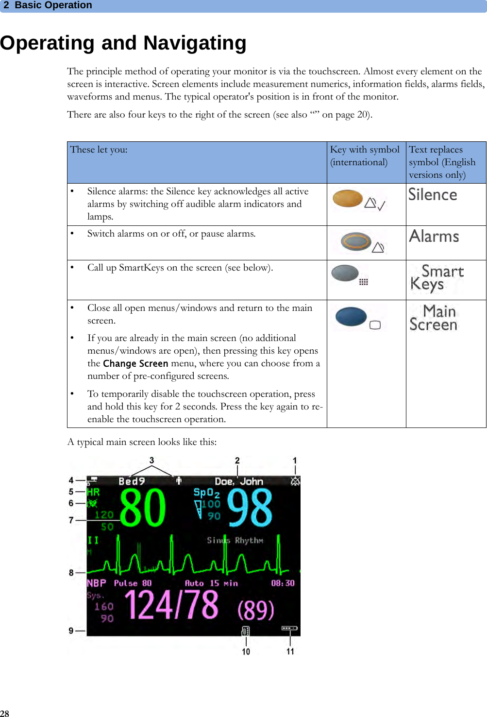 2 Basic Operation28Operating and NavigatingThe principle method of operating your monitor is via the touchscreen. Almost every element on the screen is interactive. Screen elements include measurement numerics, information fields, alarms fields, waveforms and menus. The typical operator&apos;s position is in front of the monitor.There are also four keys to the right of the screen (see also “” on page 20).A typical main screen looks like this:These let you: Key with symbol (international)Text replaces symbol (English versions only)• Silence alarms: the Silence key acknowledges all active alarms by switching off audible alarm indicators and lamps.• Switch alarms on or off, or pause alarms.• Call up SmartKeys on the screen (see below).• Close all open menus/windows and return to the main screen.• If you are already in the main screen (no additional menus/windows are open), then pressing this key opens the Change Screen menu, where you can choose from a number of pre-configured screens.• To temporarily disable the touchscreen operation, press and hold this key for 2 seconds. Press the key again to re-enable the touchscreen operation.