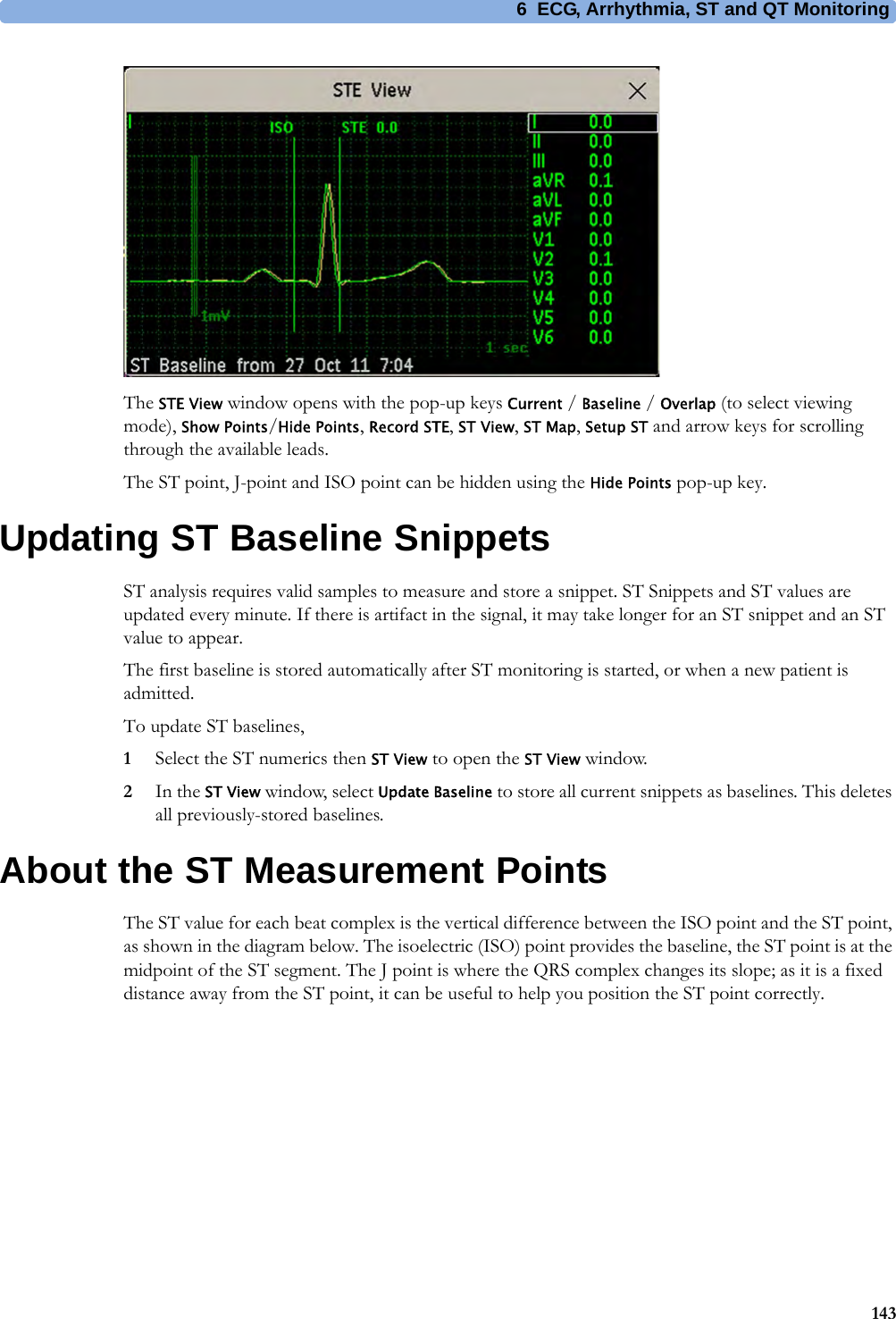 6 ECG, Arrhythmia, ST and QT Monitoring143The STE View window opens with the pop-up keys Current / Baseline / Overlap (to select viewing mode), Show Points/Hide Points, Record STE, ST View, ST Map, Setup ST and arrow keys for scrolling through the available leads.The ST point, J-point and ISO point can be hidden using the Hide Points pop-up key.Updating ST Baseline SnippetsST analysis requires valid samples to measure and store a snippet. ST Snippets and ST values are updated every minute. If there is artifact in the signal, it may take longer for an ST snippet and an ST value to appear.The first baseline is stored automatically after ST monitoring is started, or when a new patient is admitted.To update ST baselines,1Select the ST numerics then ST View to open the ST View window.2In the ST View window, select Update Baseline to store all current snippets as baselines. This deletes all previously-stored baselines.About the ST Measurement PointsThe ST value for each beat complex is the vertical difference between the ISO point and the ST point, as shown in the diagram below. The isoelectric (ISO) point provides the baseline, the ST point is at the midpoint of the ST segment. The J point is where the QRS complex changes its slope; as it is a fixed distance away from the ST point, it can be useful to help you position the ST point correctly.