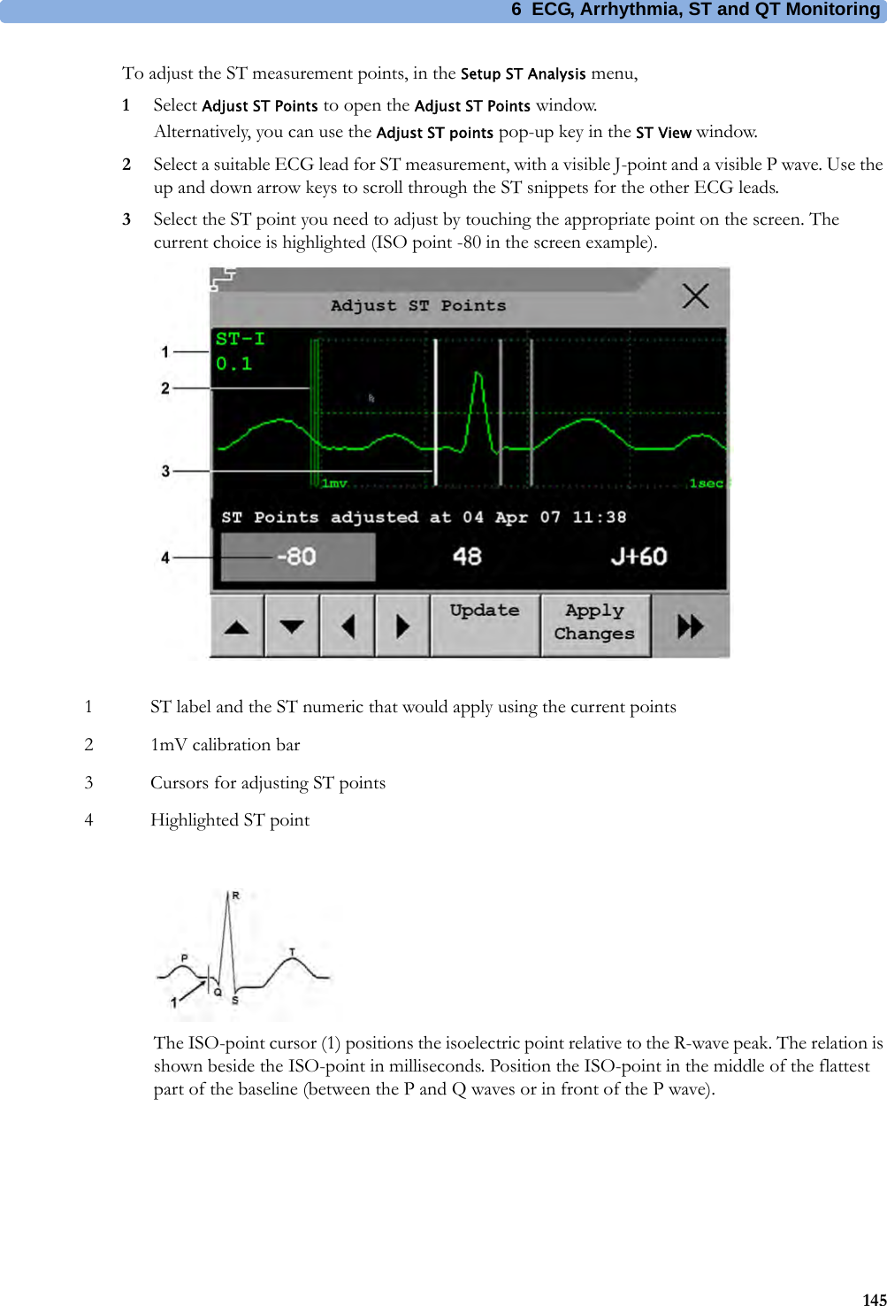 6 ECG, Arrhythmia, ST and QT Monitoring145To adjust the ST measurement points, in the Setup ST Analysis menu,1Select Adjust ST Points to open the Adjust ST Points window.Alternatively, you can use the Adjust ST points pop-up key in the ST View window.2Select a suitable ECG lead for ST measurement, with a visible J-point and a visible P wave. Use the up and down arrow keys to scroll through the ST snippets for the other ECG leads.3Select the ST point you need to adjust by touching the appropriate point on the screen. The current choice is highlighted (ISO point -80 in the screen example).The ISO-point cursor (1) positions the isoelectric point relative to the R-wave peak. The relation is shown beside the ISO-point in milliseconds. Position the ISO-point in the middle of the flattest part of the baseline (between the P and Q waves or in front of the P wave).1 ST label and the ST numeric that would apply using the current points2 1mV calibration bar3 Cursors for adjusting ST points4 Highlighted ST point
