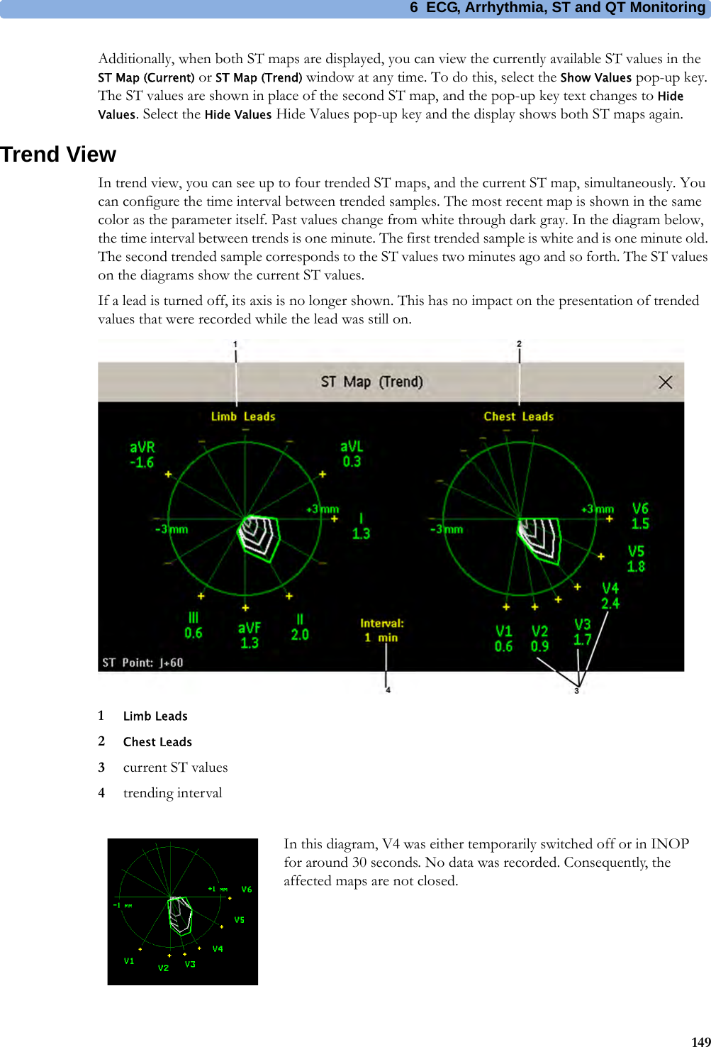 6 ECG, Arrhythmia, ST and QT Monitoring149Additionally, when both ST maps are displayed, you can view the currently available ST values in the ST Map (Current) or ST Map (Trend) window at any time. To do this, select the Show Values pop-up key. The ST values are shown in place of the second ST map, and the pop-up key text changes to Hide Values. Select the Hide Values Hide Values pop-up key and the display shows both ST maps again. Trend ViewIn trend view, you can see up to four trended ST maps, and the current ST map, simultaneously. You can configure the time interval between trended samples. The most recent map is shown in the same color as the parameter itself. Past values change from white through dark gray. In the diagram below, the time interval between trends is one minute. The first trended sample is white and is one minute old. The second trended sample corresponds to the ST values two minutes ago and so forth. The ST values on the diagrams show the current ST values.If a lead is turned off, its axis is no longer shown. This has no impact on the presentation of trended values that were recorded while the lead was still on.1Limb Leads2Chest Leads3current ST values4trending intervalIn this diagram, V4 was either temporarily switched off or in INOP for around 30 seconds. No data was recorded. Consequently, the affected maps are not closed.