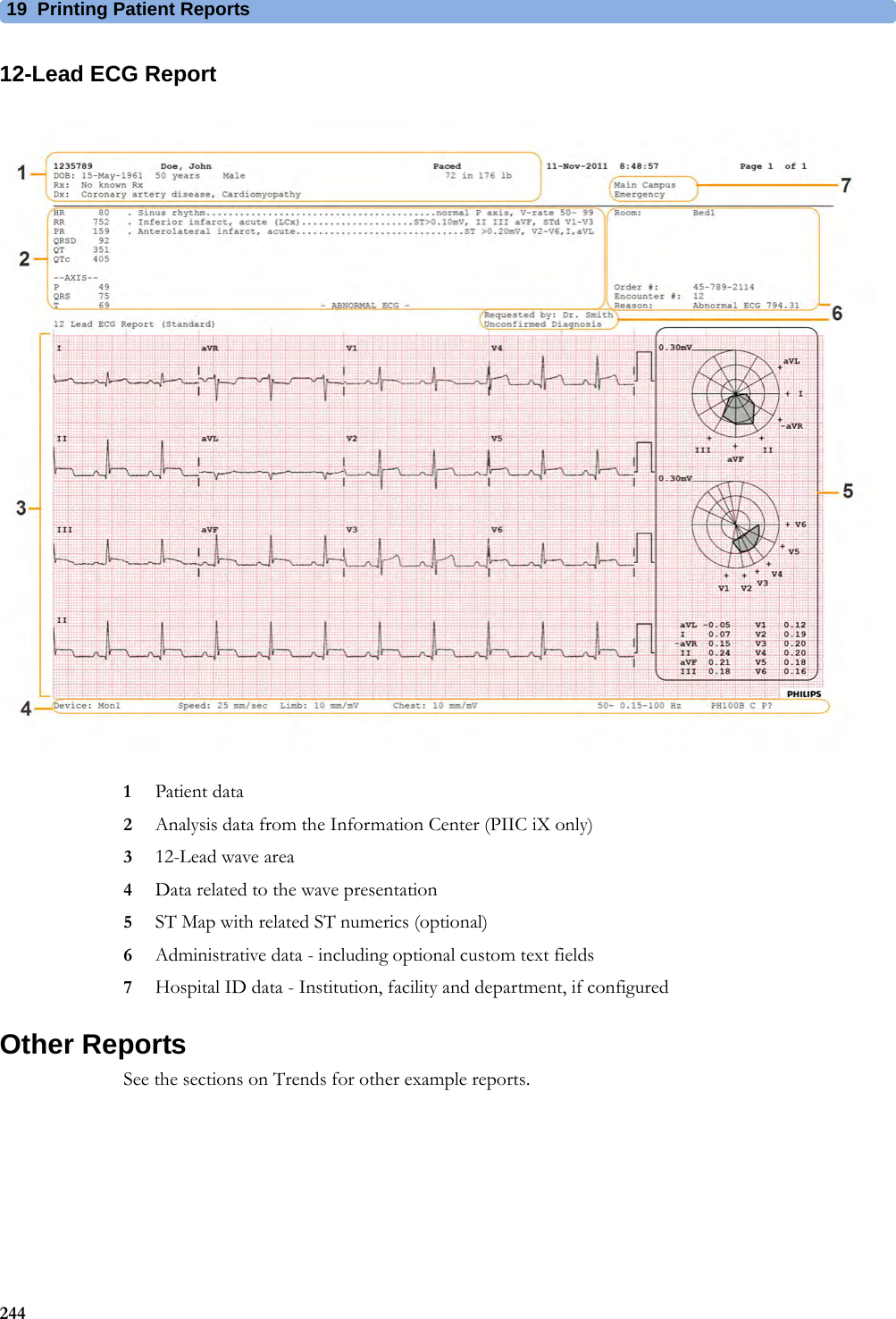 19 Printing Patient Reports24412-Lead ECG Report1Patient data2Analysis data from the Information Center (PIIC iX only)312-Lead wave area4Data related to the wave presentation5ST Map with related ST numerics (optional)6Administrative data - including optional custom text fields7Hospital ID data - Institution, facility and department, if configuredOther ReportsSee the sections on Trends for other example reports.
