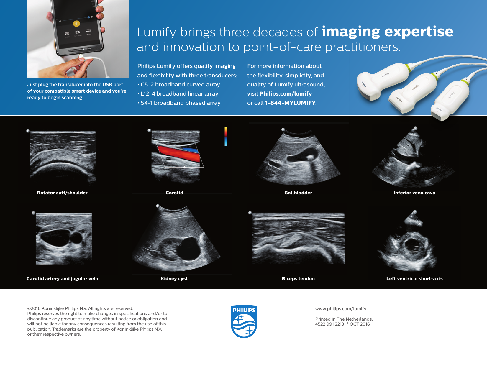 Page 4 of 4 - Philips  Product Brochure 452299122131 Lumify E FNL Lr Oct16