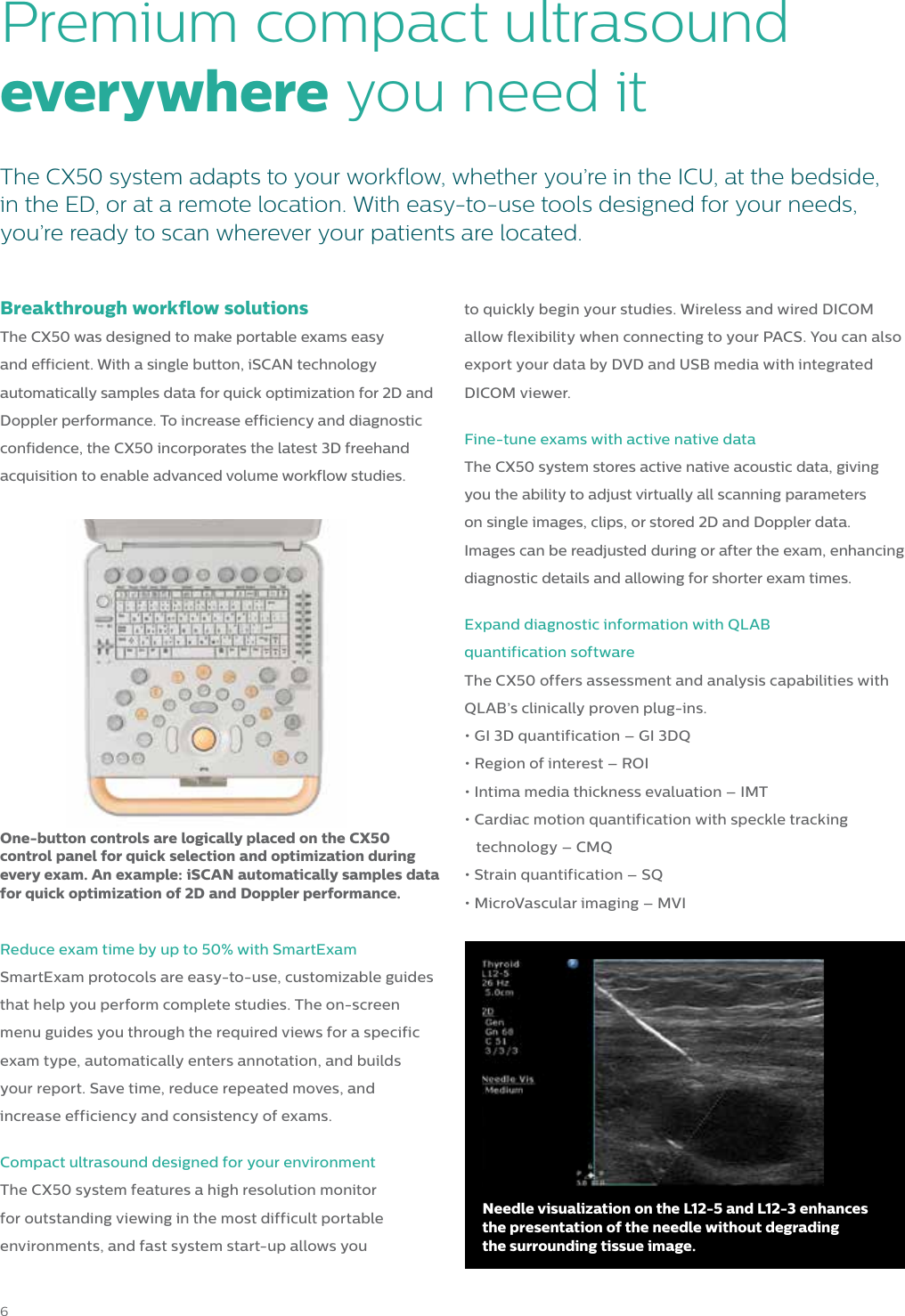 Page 6 of 8 - Philips 795076GI User Manual Product Brochure CX50 General Imaging Ultrasound System Cbcd5c5549d14fa096b2a77c0161aee4