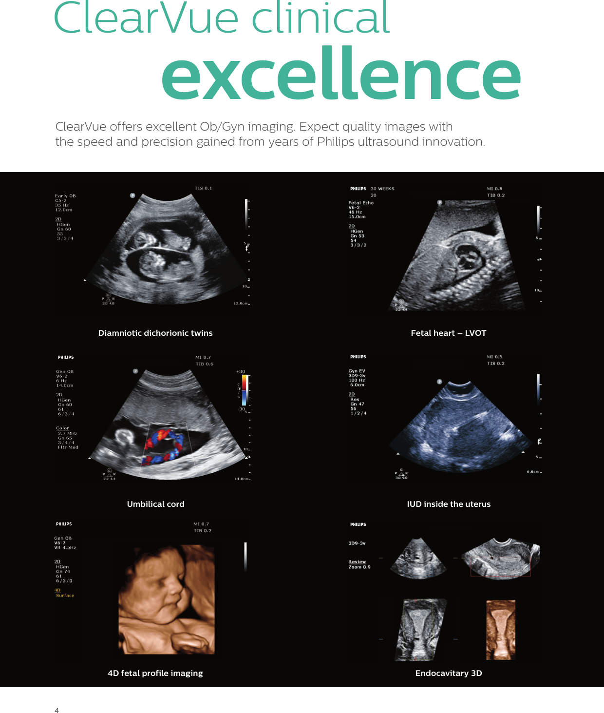 Page 4 of 12 - Philips 795094 User Manual Women's Health Care Clear Vue Platform Brochure For Womens Healthcare?func=doc