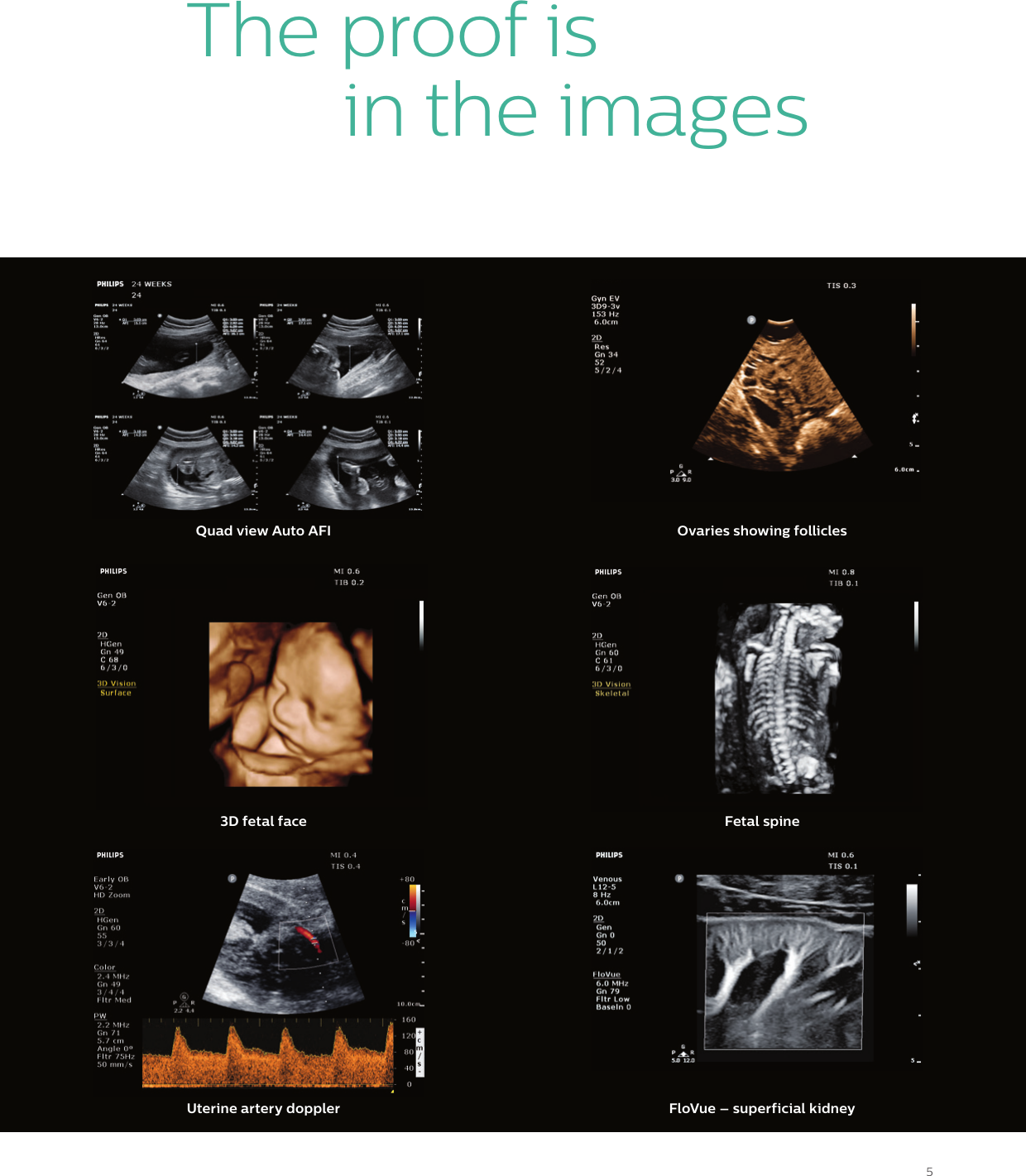 Page 5 of 12 - Philips 795094 User Manual Women's Health Care Clear Vue Platform Brochure For Womens Healthcare?func=doc