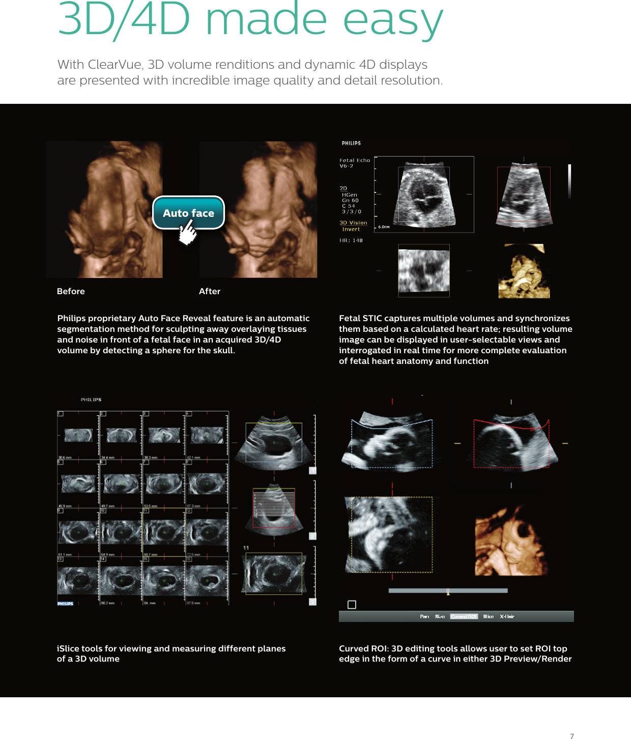 Page 7 of 12 - Philips 795094 User Manual Women's Health Care Clear Vue Platform Brochure For Womens Healthcare?func=doc