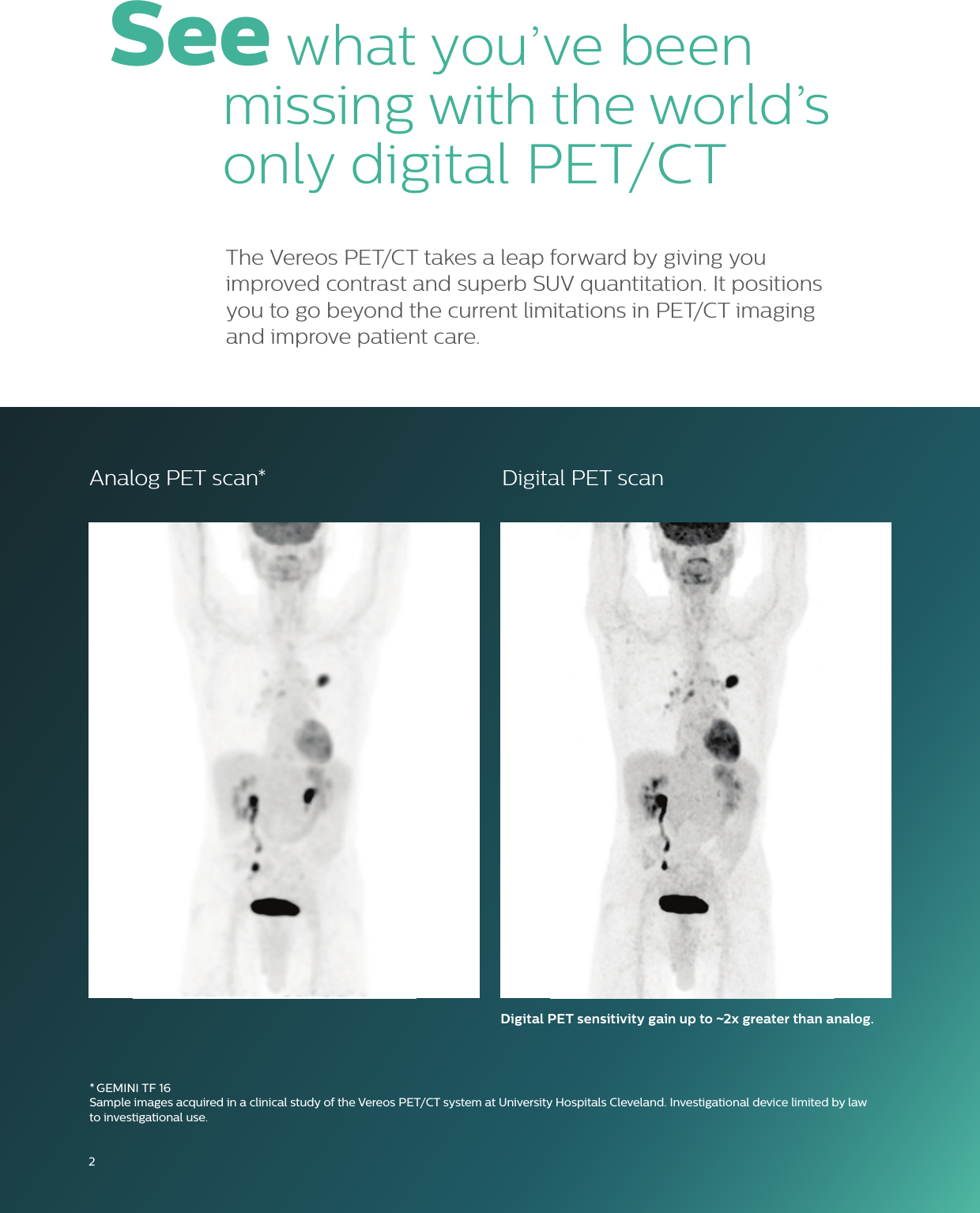 Page 2 of 8 - Philips 882446 User Manual Product Brochure Vereos The World's First And Only True Digital PET/CT System A329f5f78a1348ea9d0aa77c01566ca6