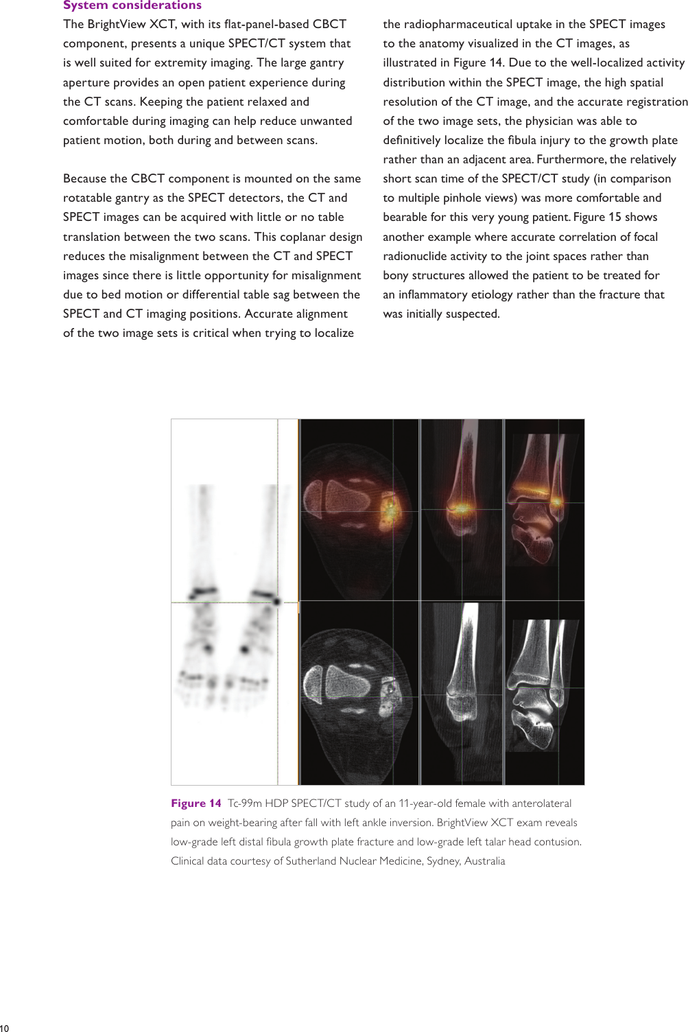 Page 10 of 12 - Philips 882482 User Manual Product Brochure Bright View SPECT/CT System XCT Df2a879f418243d9a589a77c01489b87