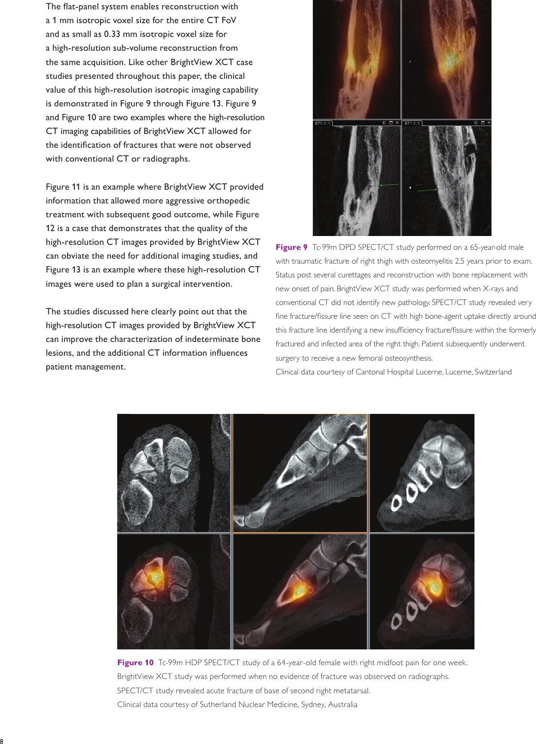 Page 8 of 12 - Philips 882482 User Manual Product Brochure Bright View SPECT/CT System XCT Df2a879f418243d9a589a77c01489b87