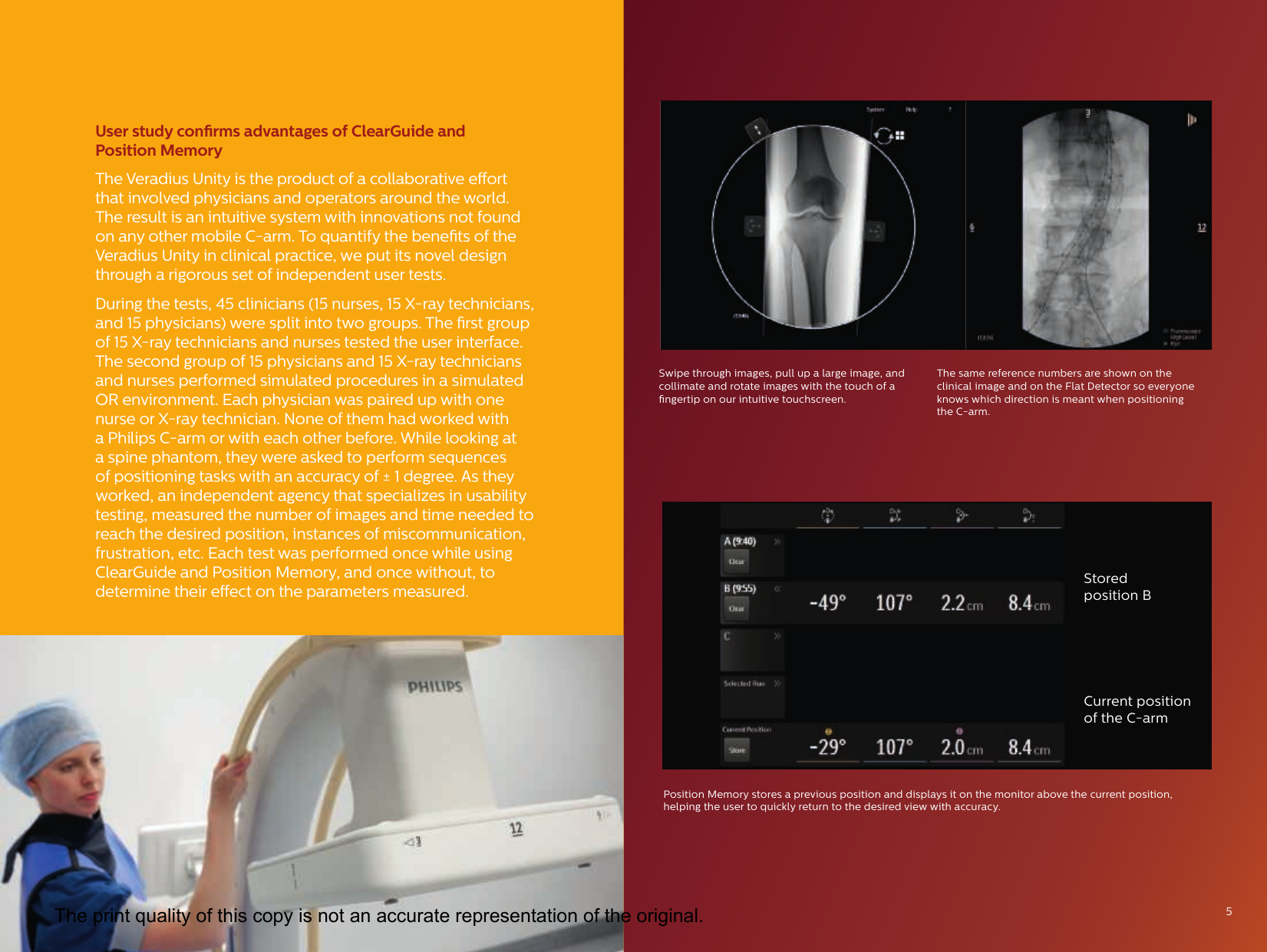 Page 5 of 12 - Philips 989806103039 452299116671 User Manual Veradius Unity Mobile C-arm Product Brochure 20c4493b2a4d4c24b7dca7a600daa8b3