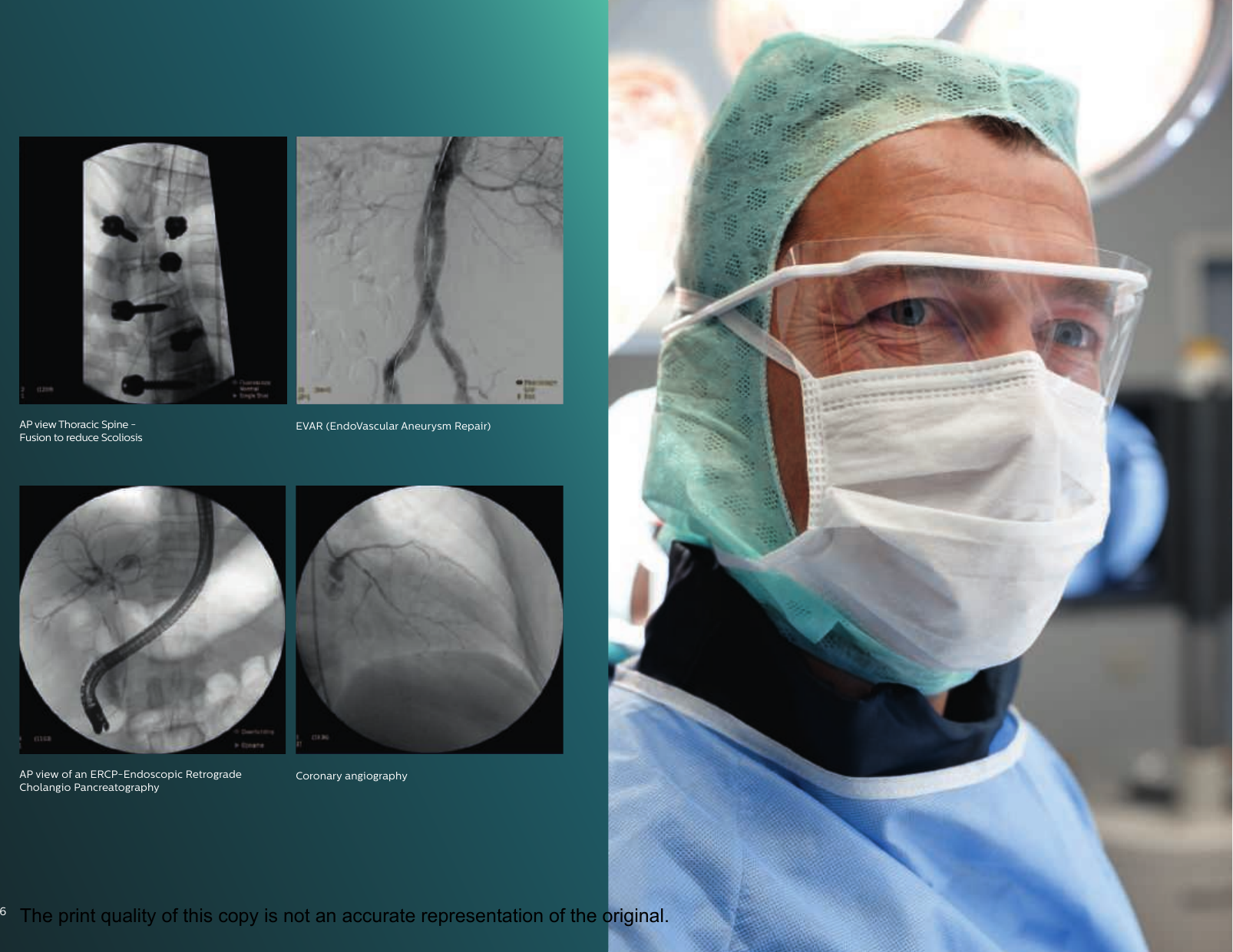 Page 6 of 12 - Philips 989806103039 452299116671 User Manual Veradius Unity Mobile C-arm Product Brochure 20c4493b2a4d4c24b7dca7a600daa8b3