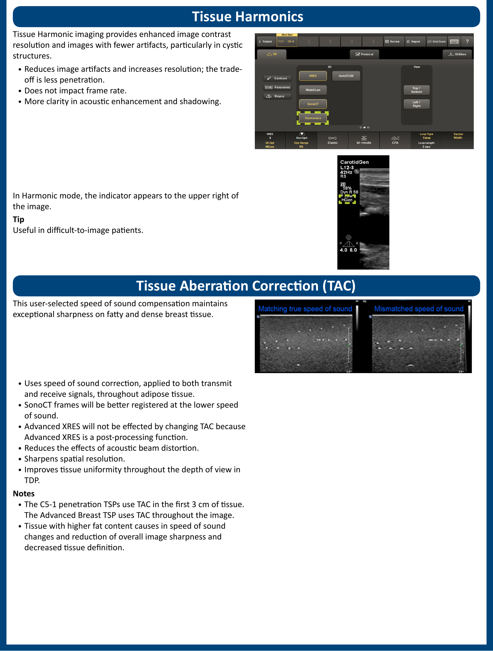 Page 4 of 6 - Philips  Learn More EPIC Control Surface QG 20160511 V01