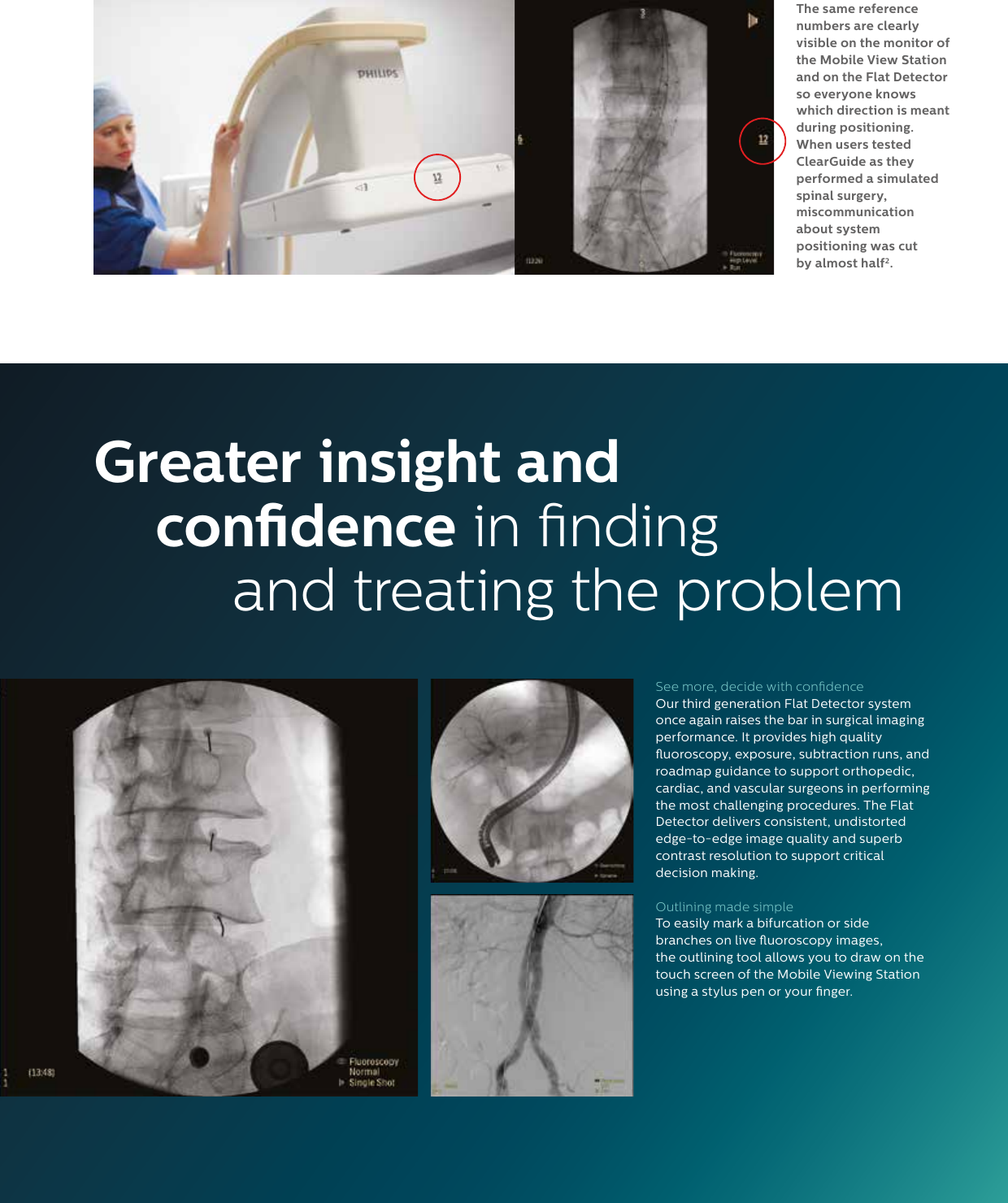 Page 3 of 4 - Philips NOCTN277 User Manual Product Brochure Veradius Unity Mobile C-arm With Flat Detector 3b7f07d66a7145dab9d9a77c015e7454